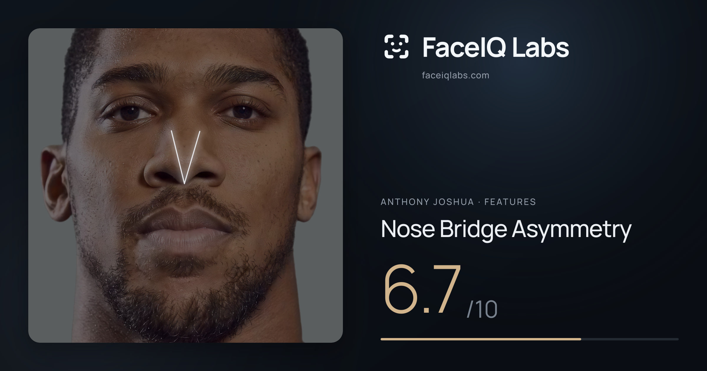 Anthony Joshua Nose Bridge Asymmetry: 6.7/10, drawn on the photo
