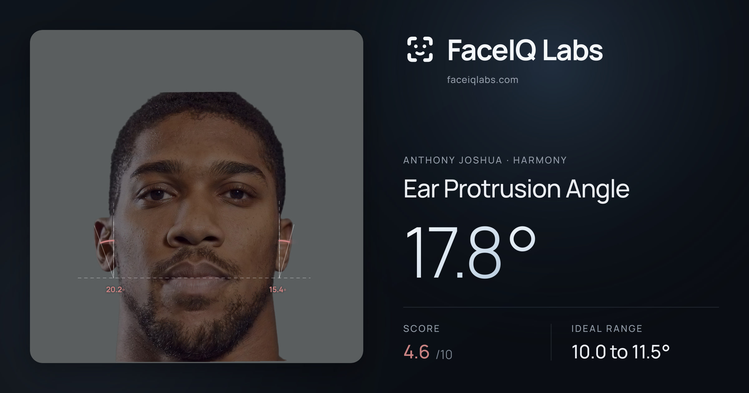 Anthony Joshua Ear Protrusion Angle: 17.8°, drawn on the photo