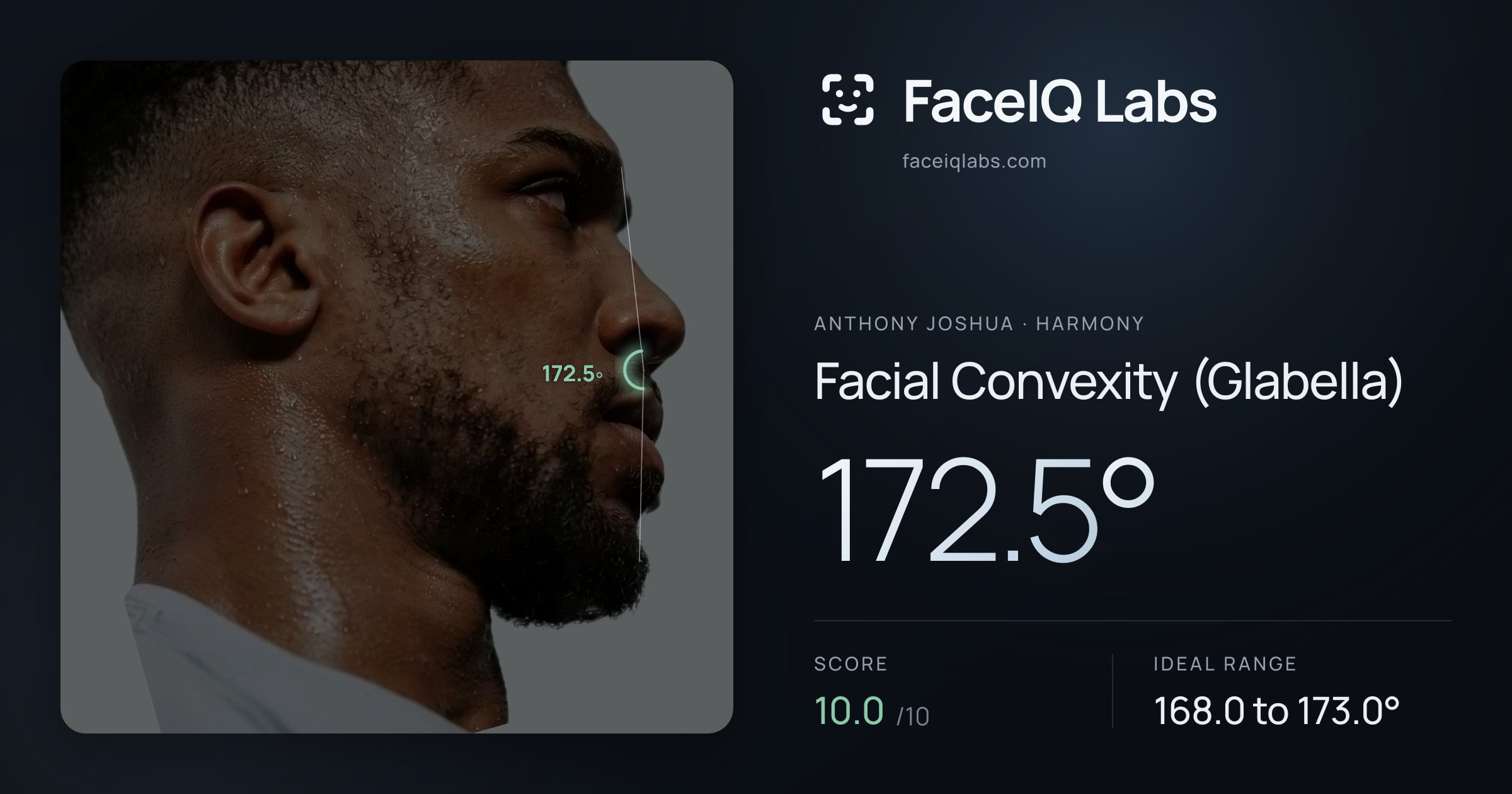 Anthony Joshua Facial Convexity (Glabella): 172.5°, drawn on the photo