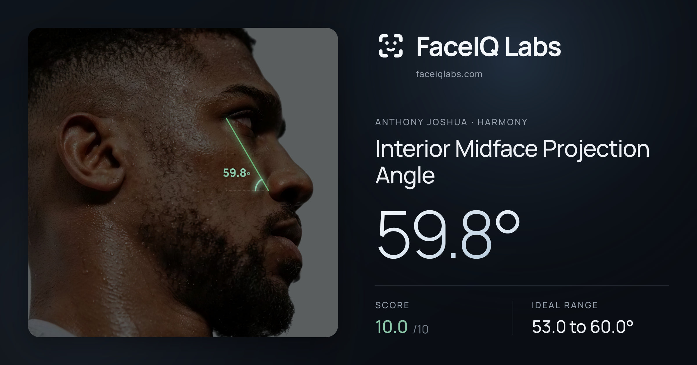 Anthony Joshua Interior Midface Projection Angle: 59.8°, drawn on the photo
