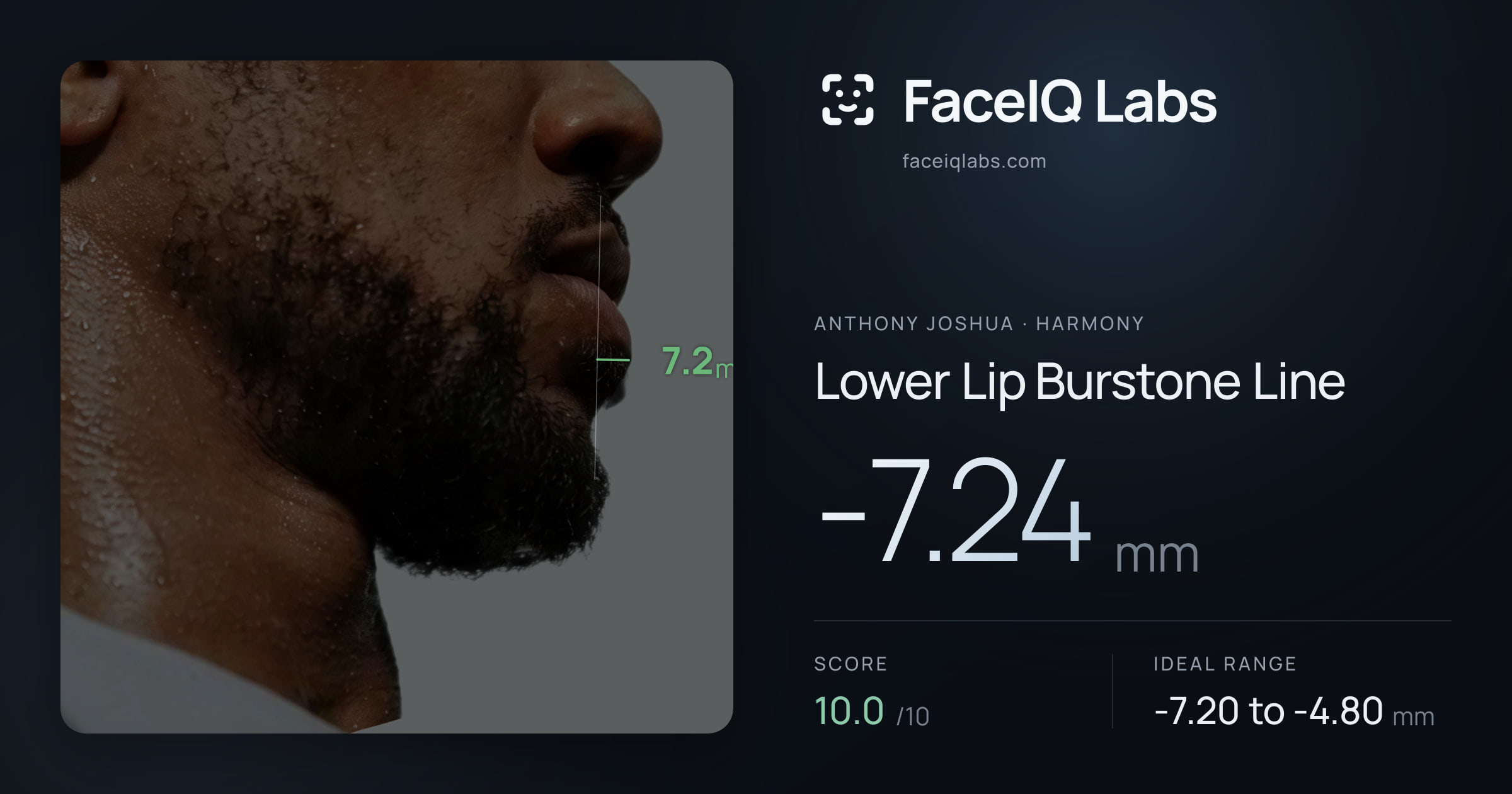 Anthony Joshua Lower Lip Burstone Line: -7.24mm, drawn on the photo