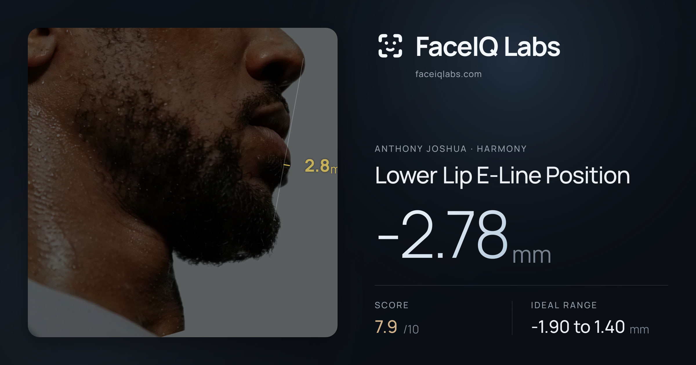 Anthony Joshua Lower Lip E-Line Position: -2.78mm, drawn on the photo
