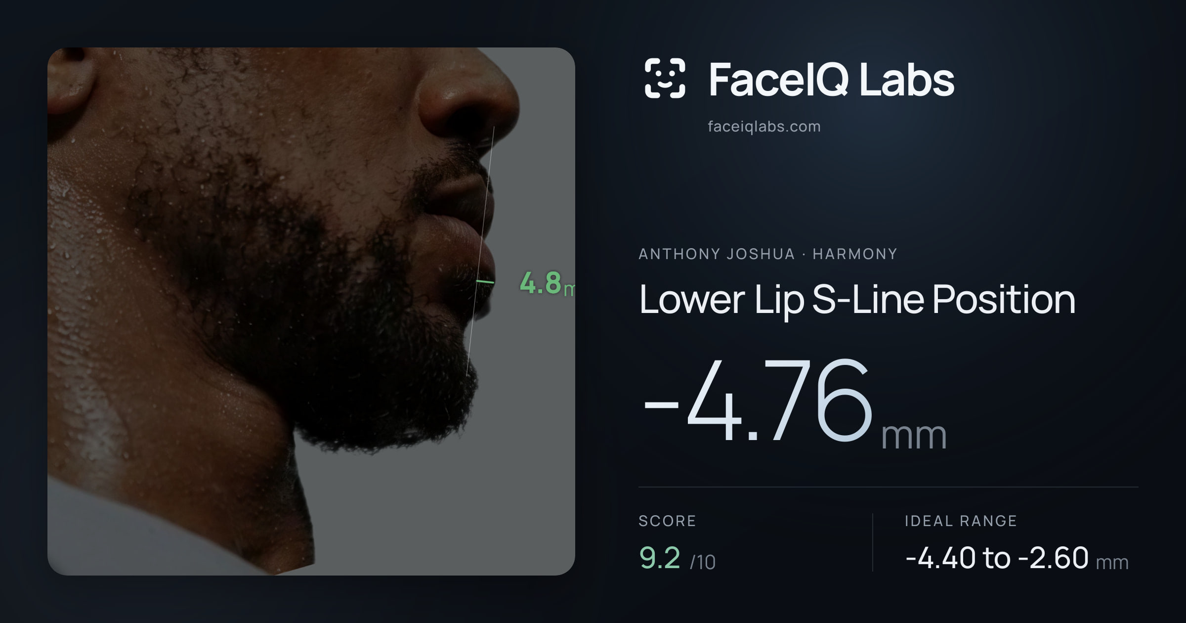 Anthony Joshua Lower Lip S-Line Position: -4.76mm, drawn on the photo