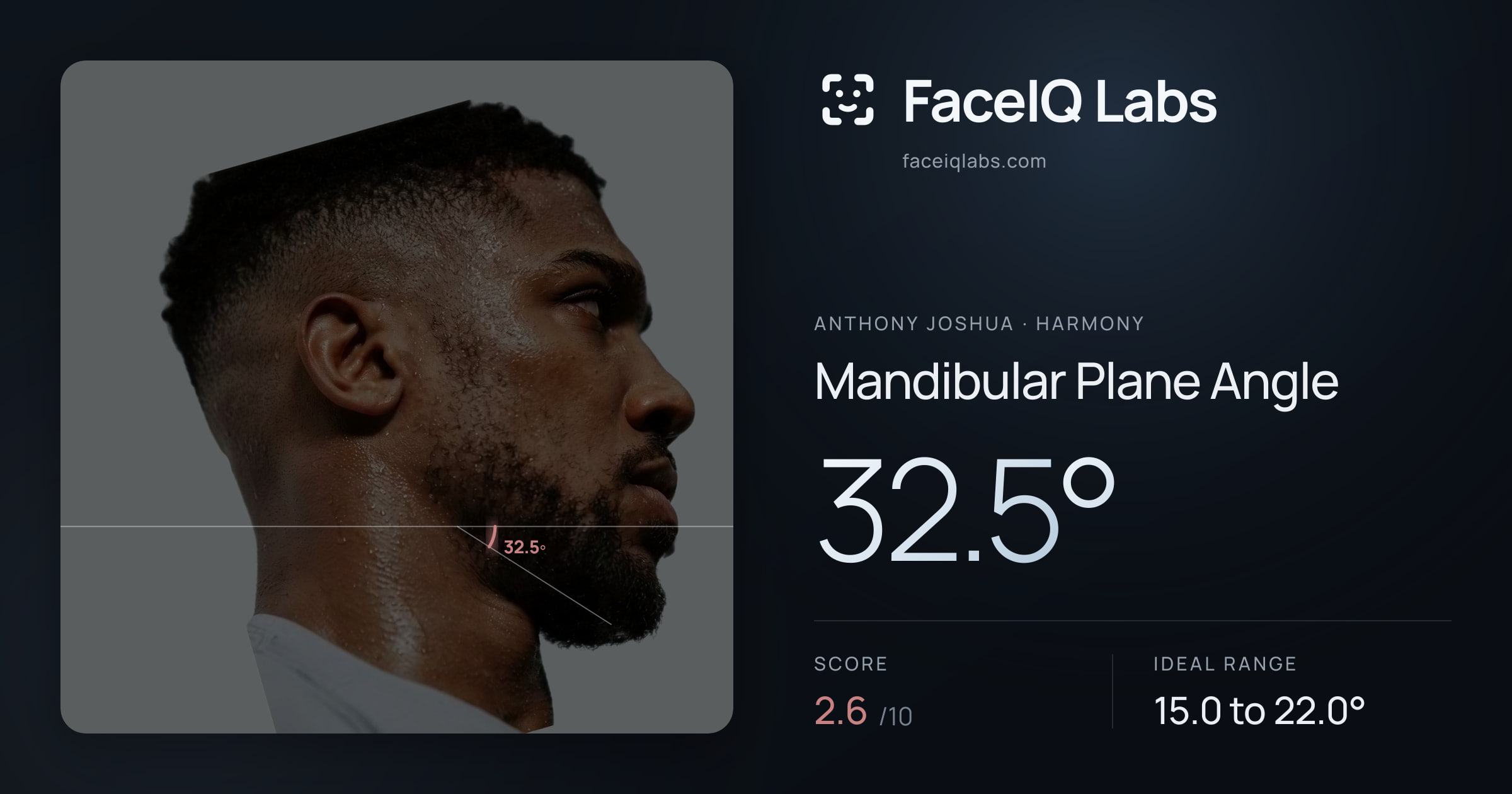 Anthony Joshua Mandibular Plane Angle: 32.5°, drawn on the photo