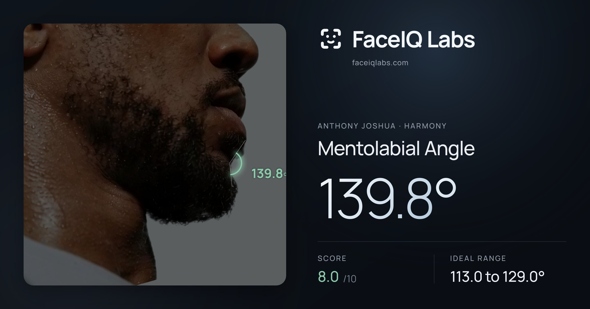 Anthony Joshua Mentolabial Angle: 139.8°, drawn on the photo