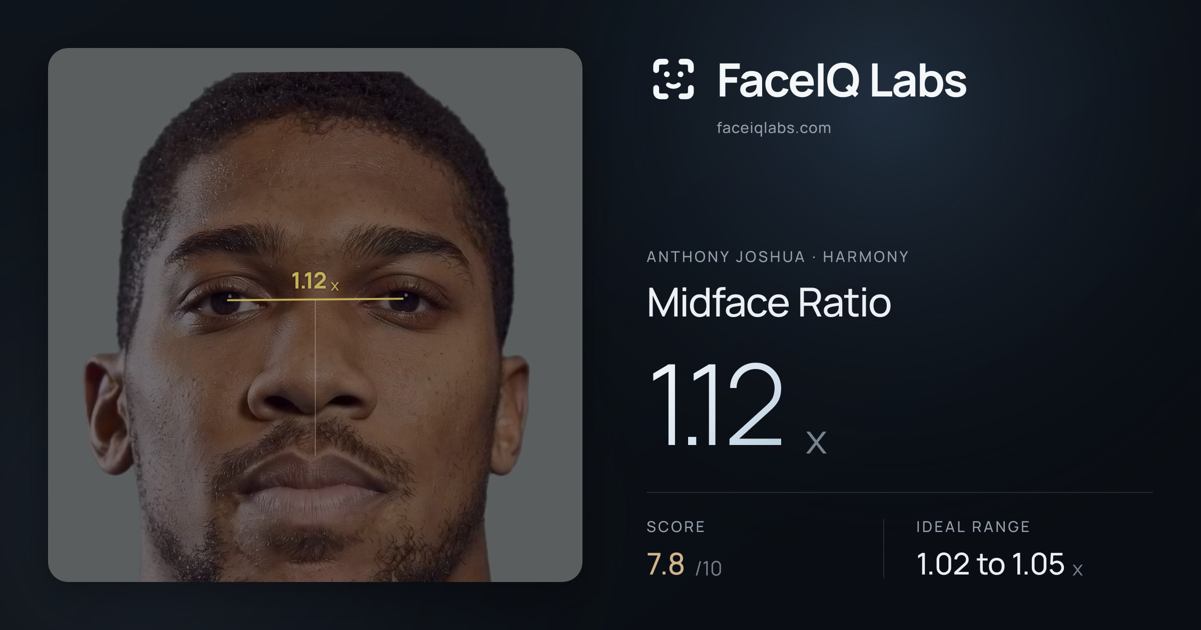 Anthony Joshua Midface Ratio: 1.12x, drawn on the photo