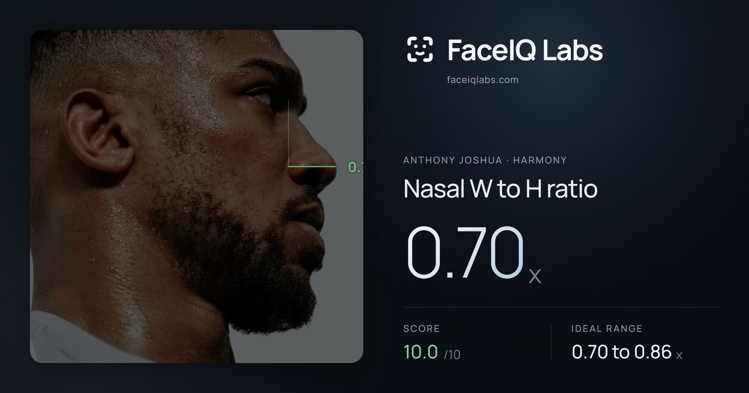 Anthony Joshua Nasal W to H ratio: 0.70x, drawn on the photo
