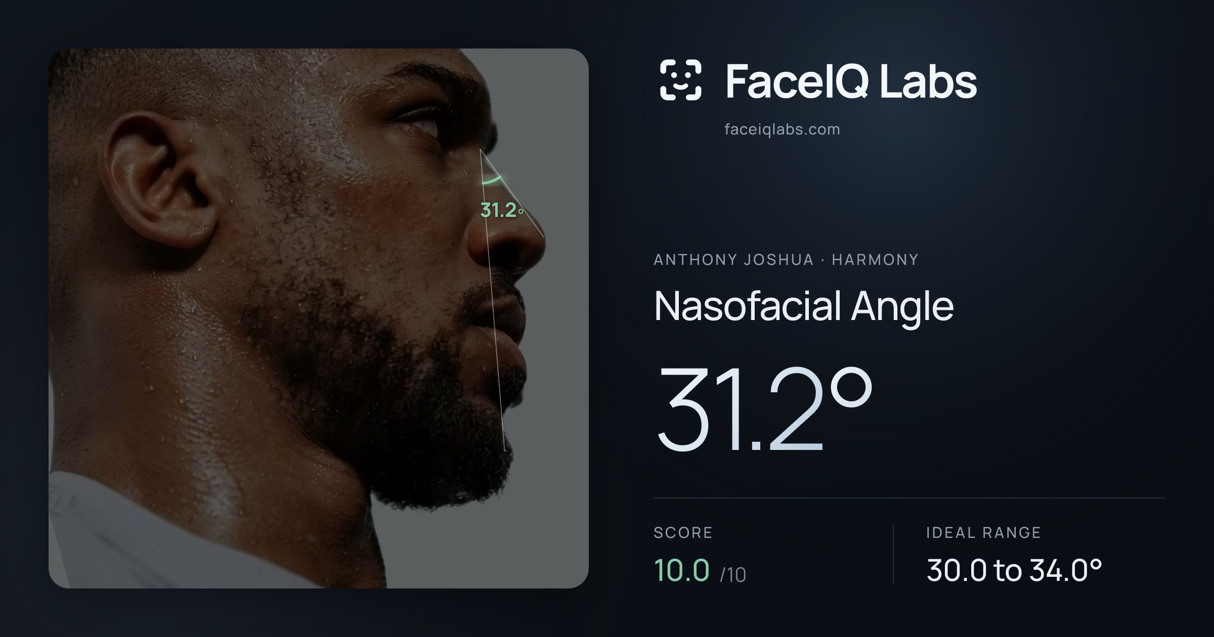 Anthony Joshua Nasofacial Angle: 31.2°, drawn on the photo
