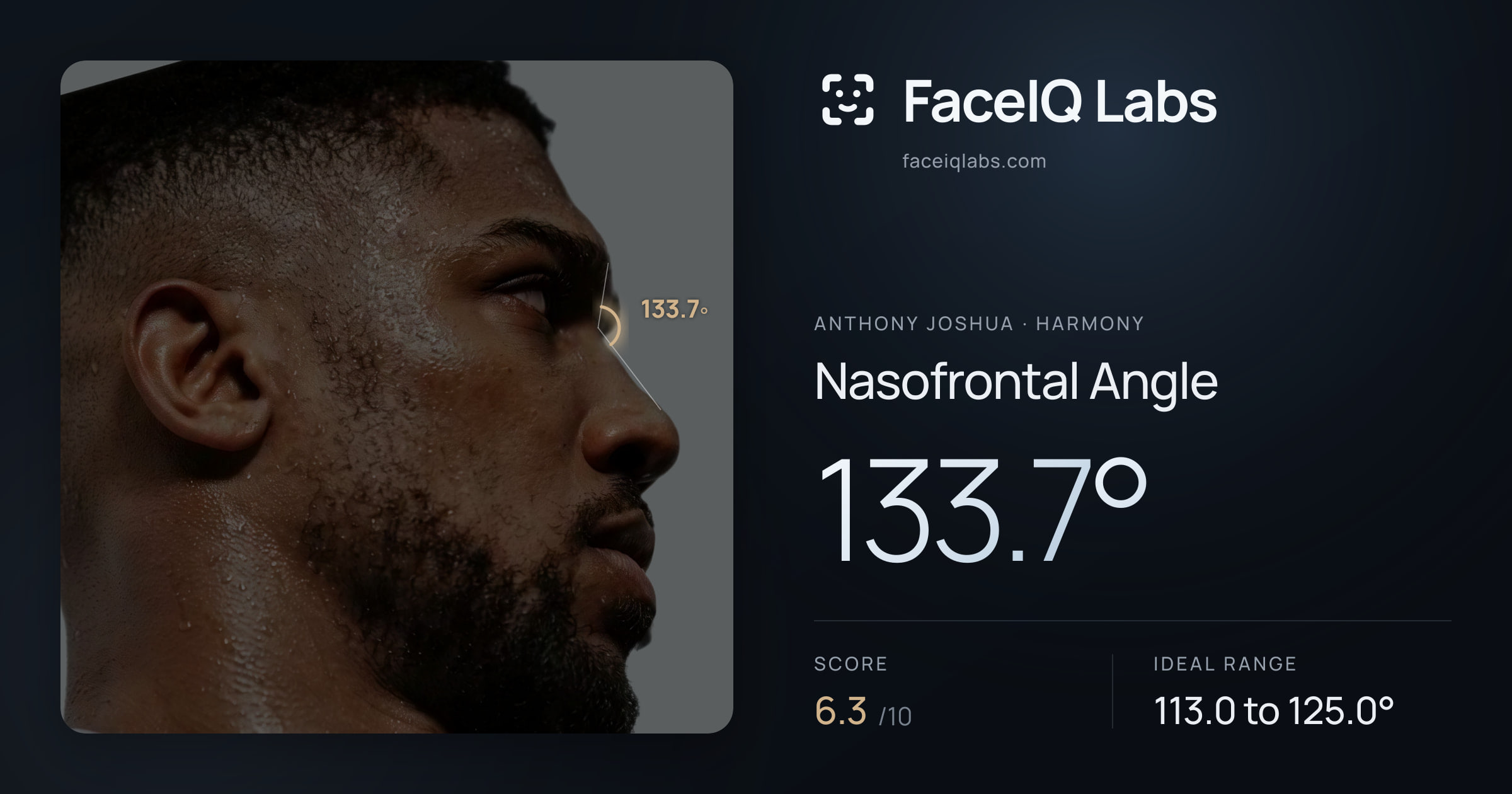 Anthony Joshua Nasofrontal Angle: 133.7°, drawn on the photo