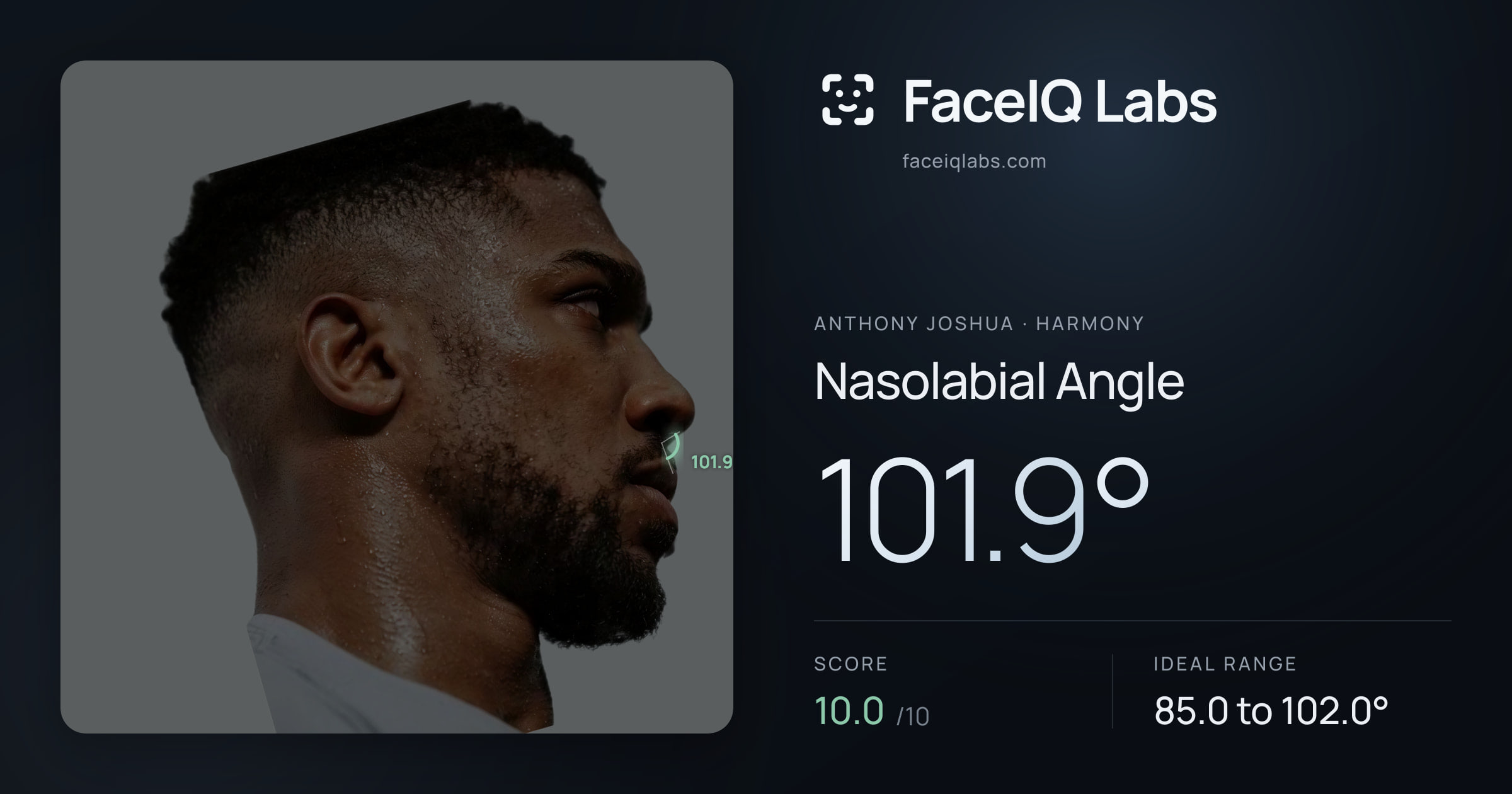 Anthony Joshua Nasolabial Angle: 101.9°, drawn on the photo