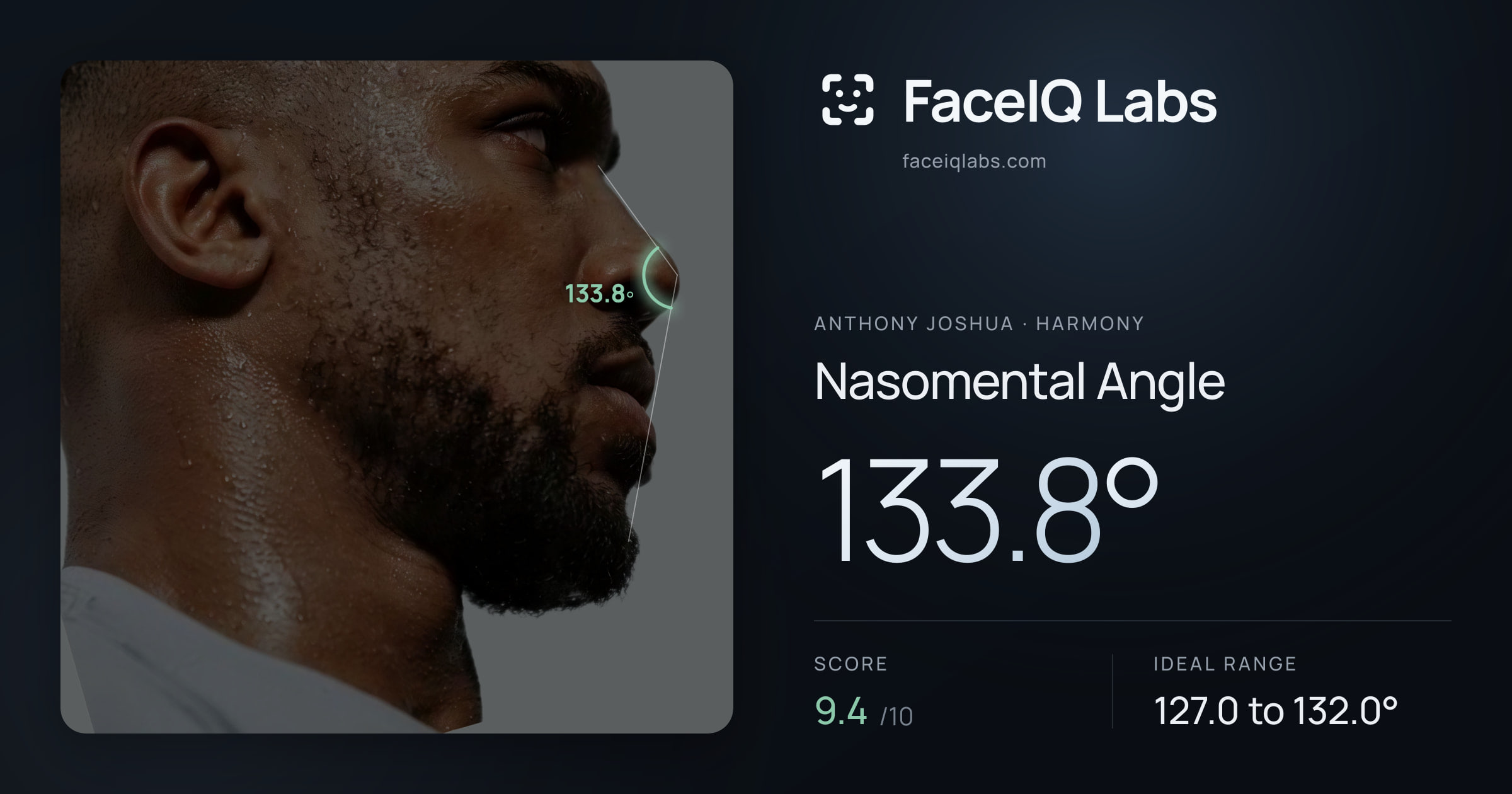Anthony Joshua Nasomental Angle: 133.8°, drawn on the photo
