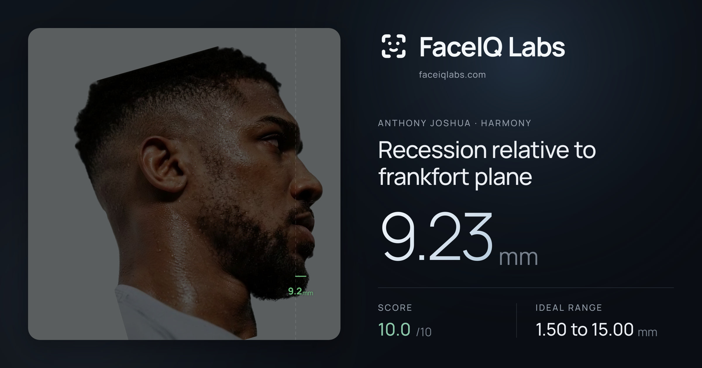 Anthony Joshua Recession relative to frankfort plane: 9.23mm, drawn on the photo