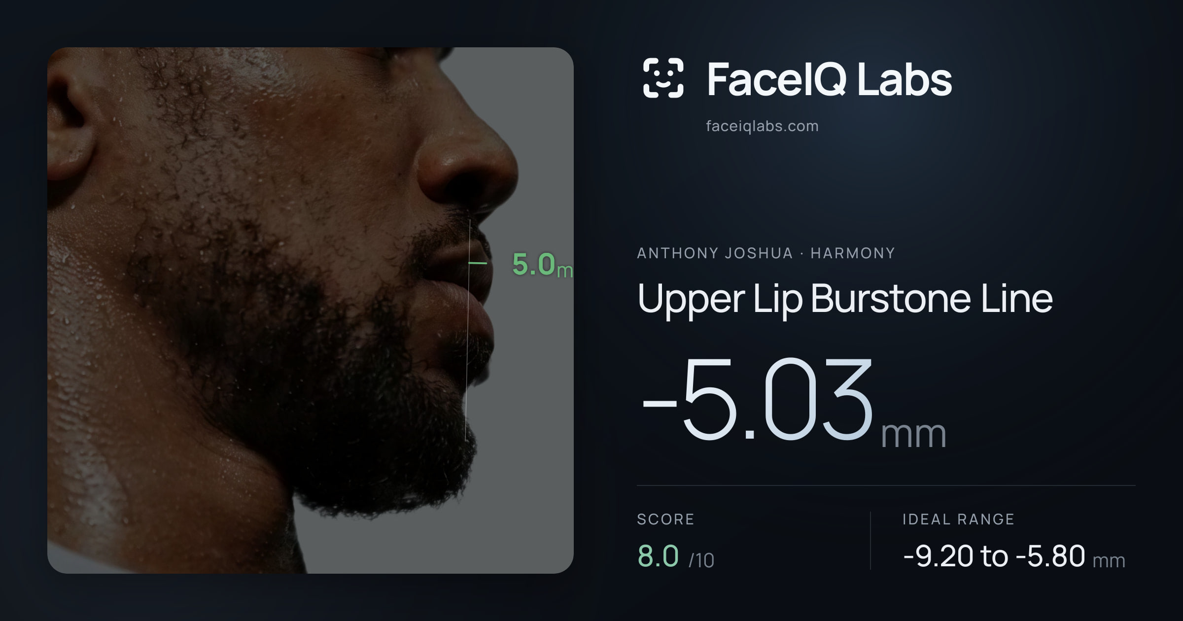 Anthony Joshua Upper Lip Burstone Line: -5.03mm, drawn on the photo