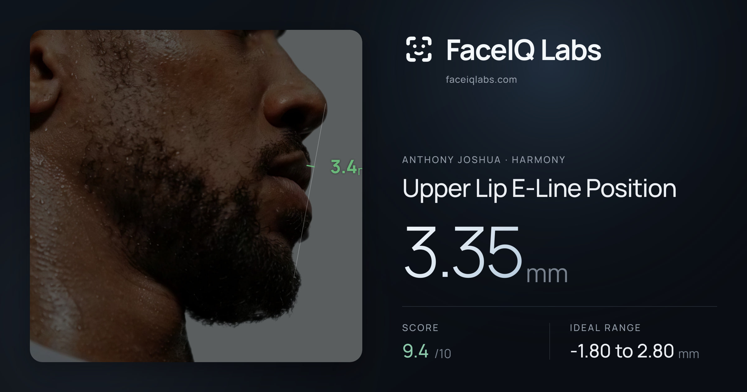 Anthony Joshua Upper Lip E-Line Position: 3.35mm, drawn on the photo