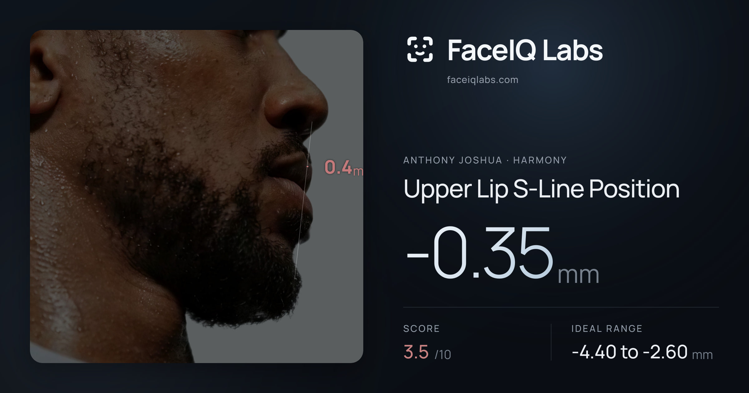 Anthony Joshua Upper Lip S-Line Position: -0.35mm, drawn on the photo