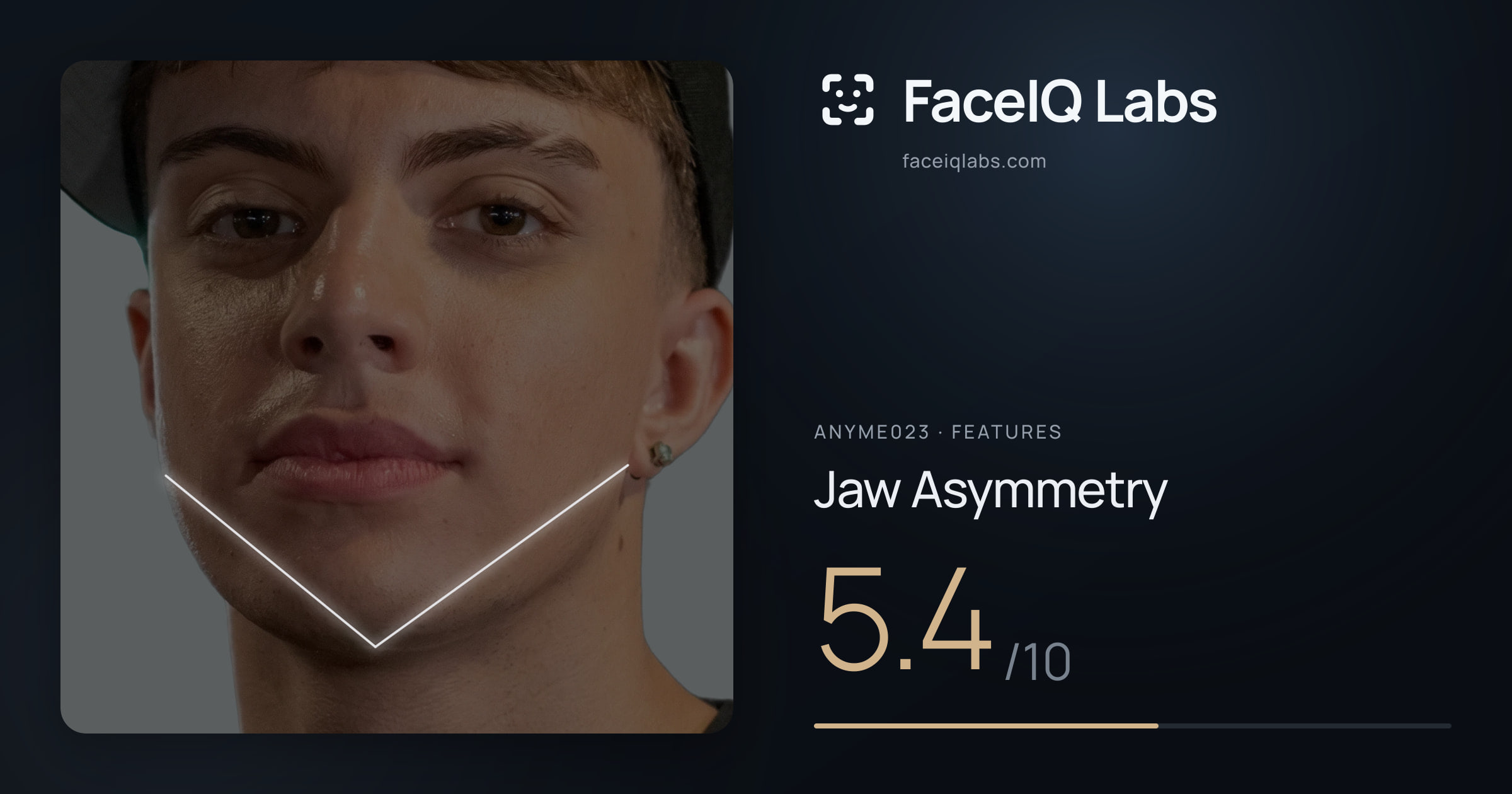 Anyme023 Jaw Asymmetry: 5.4/10, drawn on the photo