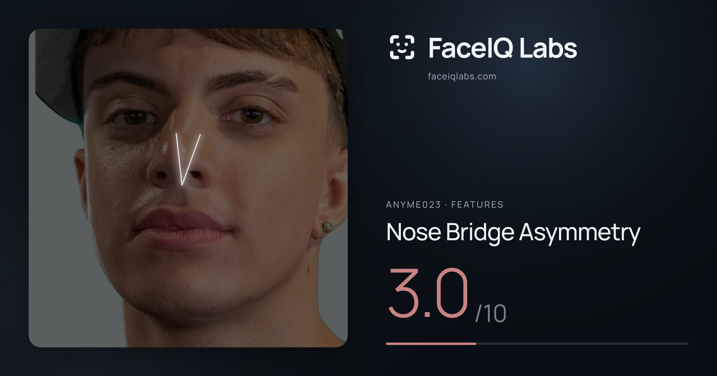 Anyme023 Nose Bridge Asymmetry: 3.0/10, drawn on the photo