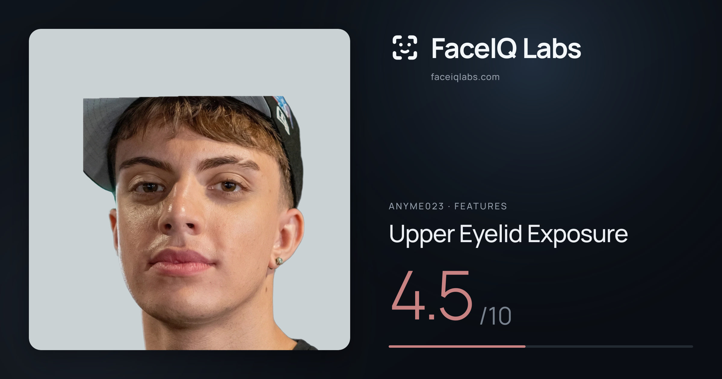 Anyme023 Upper Eyelid Exposure: 4.5/10, drawn on the photo