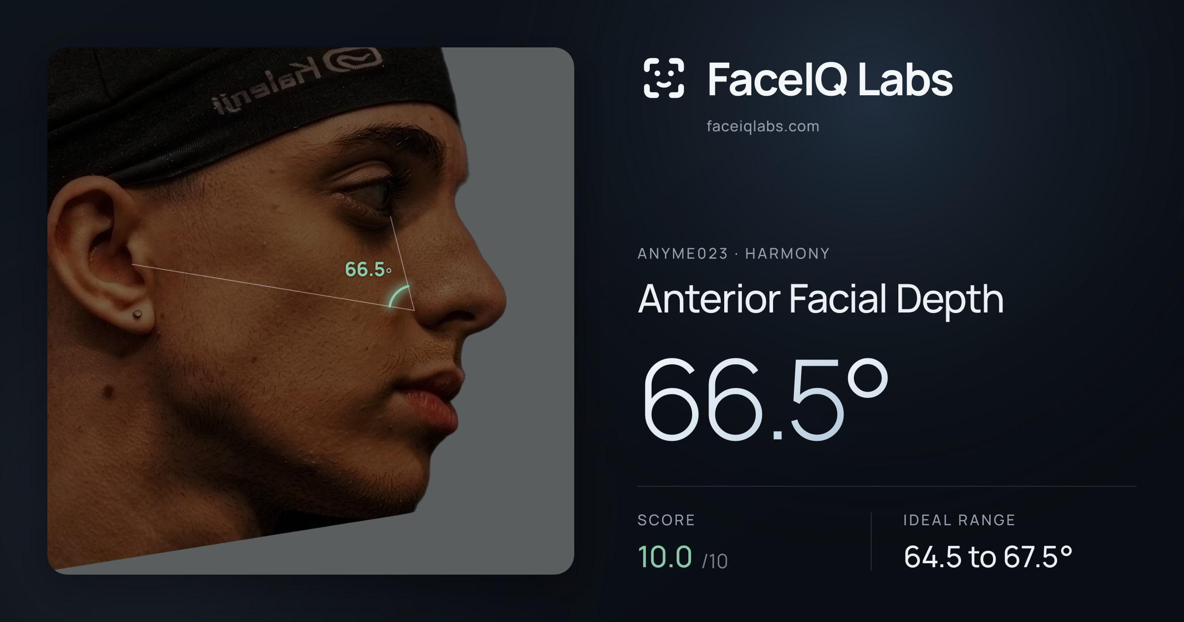Anyme023 Anterior Facial Depth: 66.5°, drawn on the photo