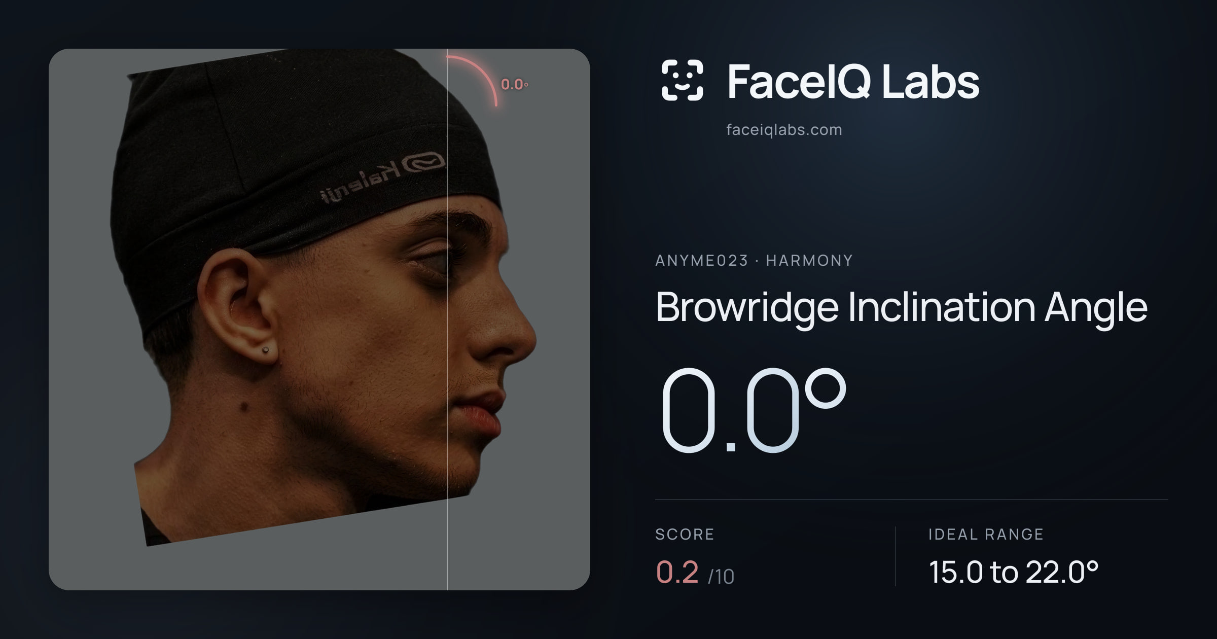 Anyme023 Browridge Inclination Angle: 0.0°, drawn on the photo