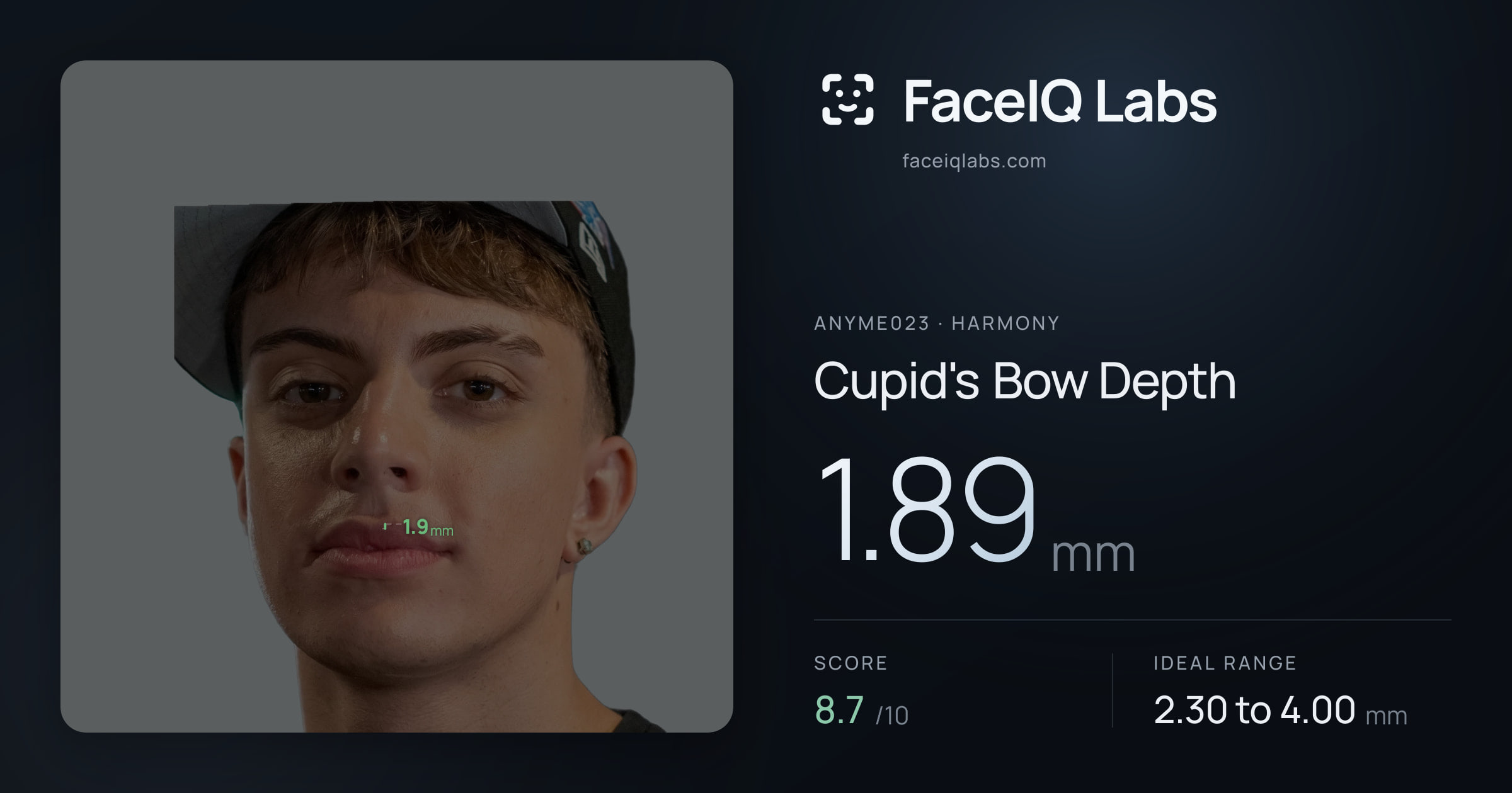 Anyme023 Cupid's Bow Depth: 1.89mm, drawn on the photo