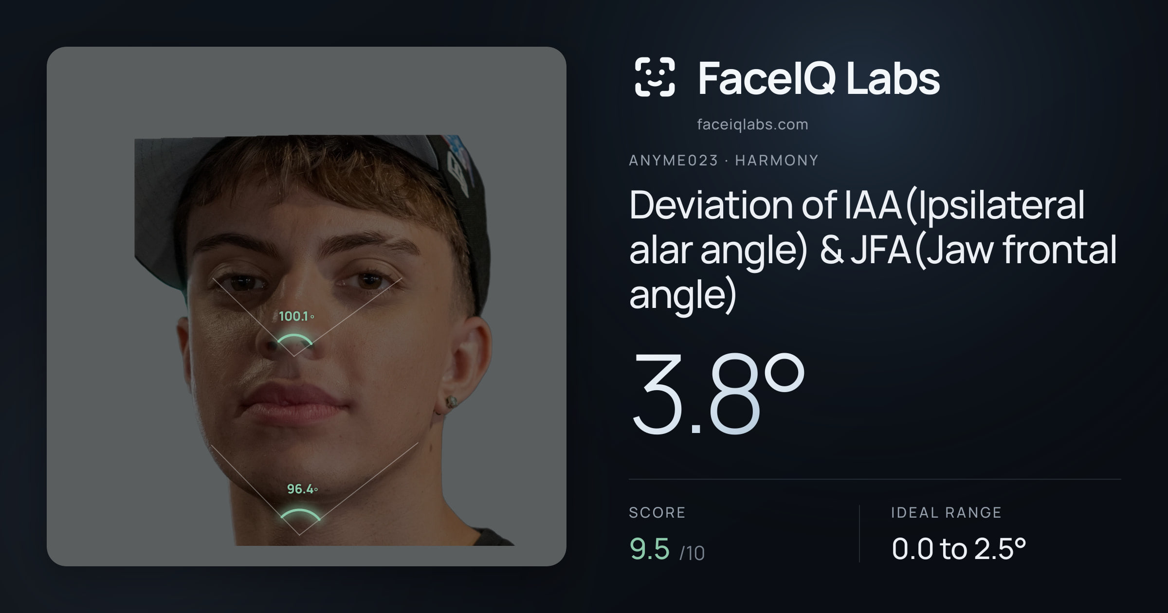 Anyme023 Deviation of IAA(Ipsilateral alar angle) & JFA(Jaw frontal angle): 3.8°, drawn on the photo