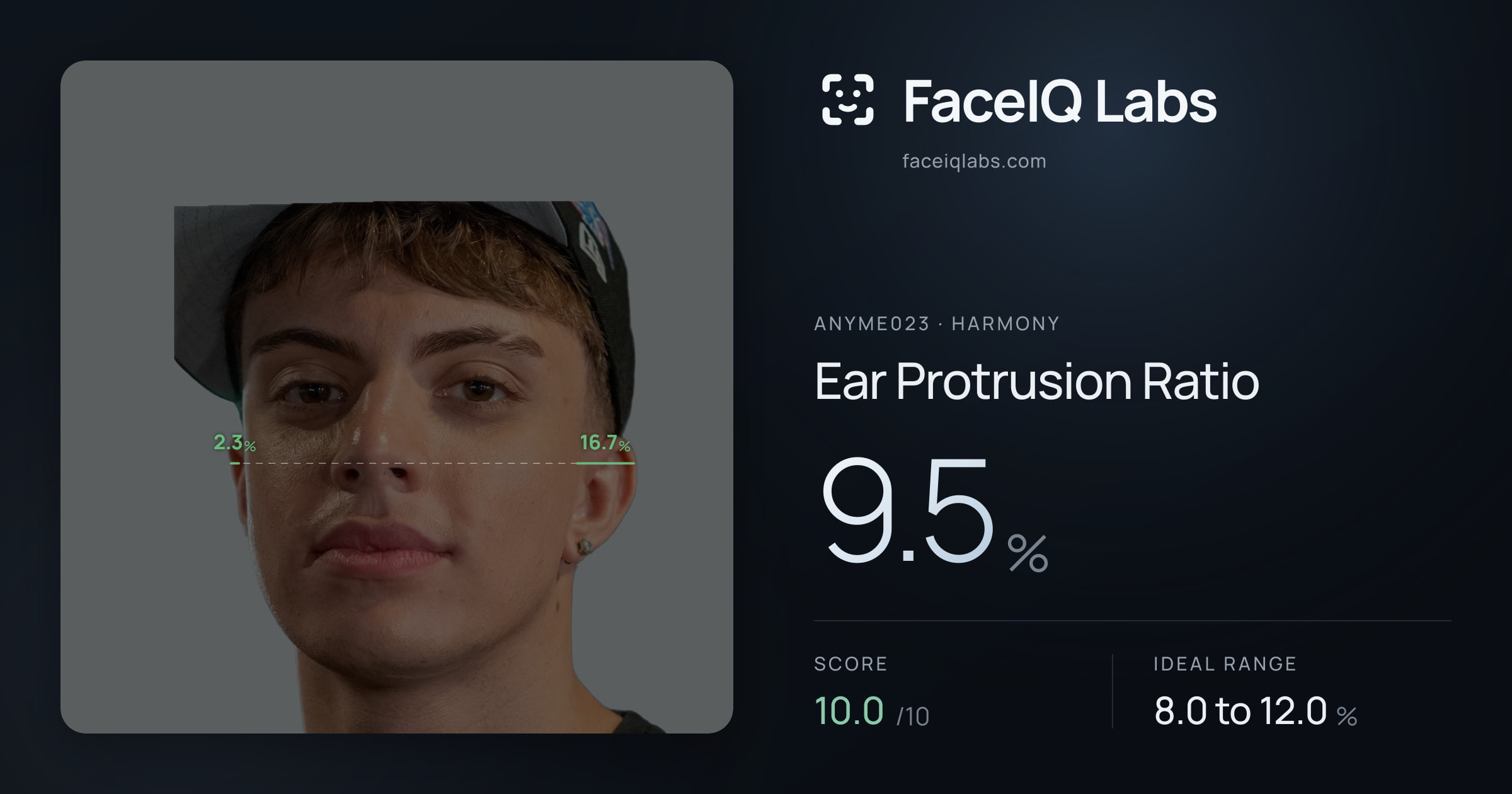Anyme023 Ear Protrusion Ratio: 9.5%, drawn on the photo