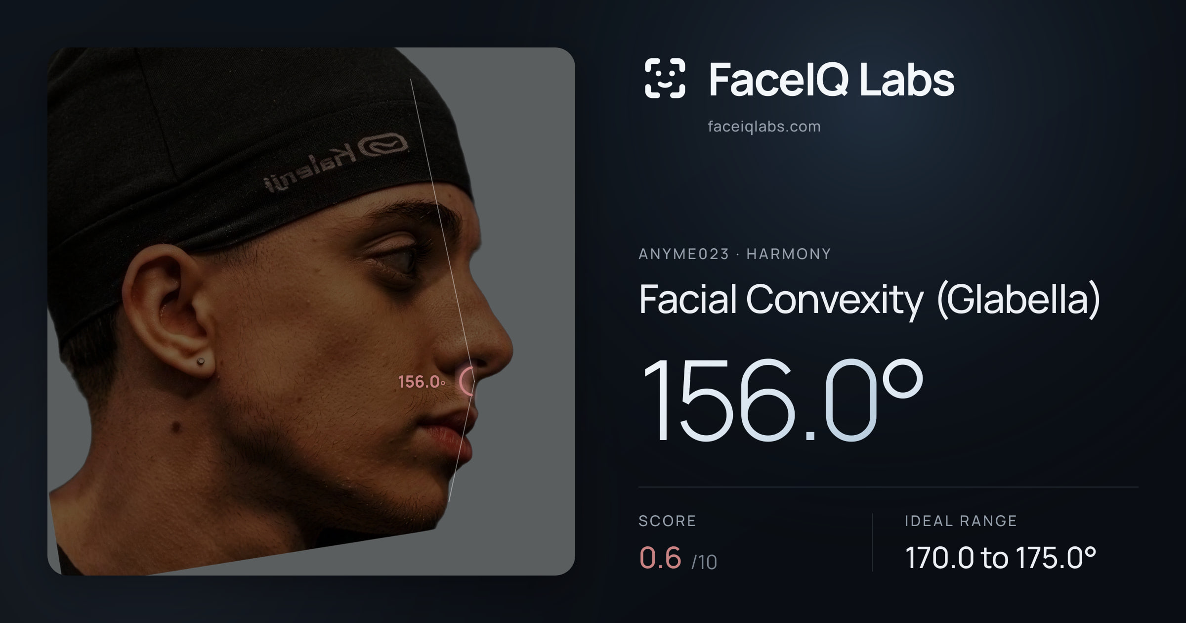 Anyme023 Facial Convexity (Glabella): 156.0°, drawn on the photo