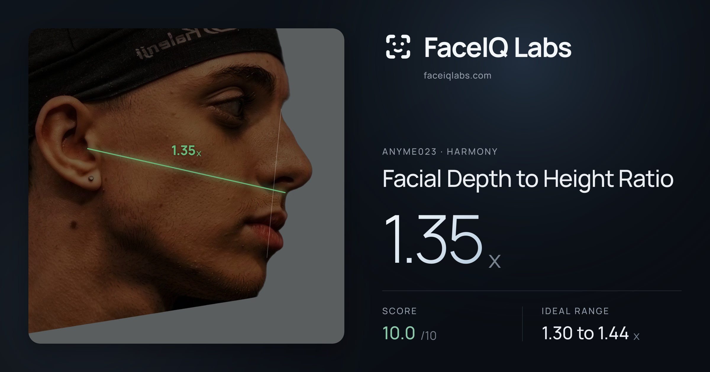 Anyme023 Facial Depth to Height Ratio: 1.35x, drawn on the photo