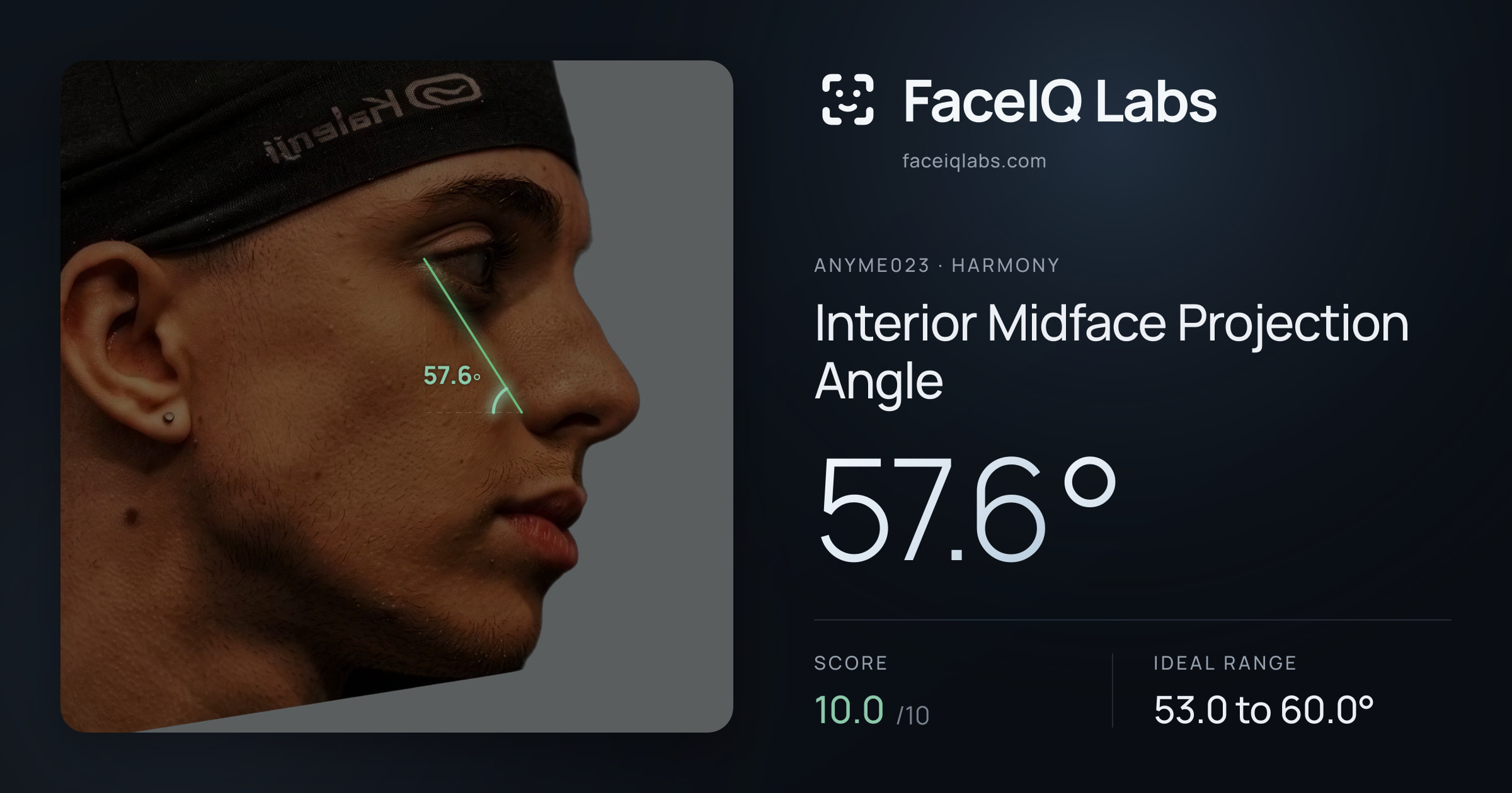 Anyme023 Interior Midface Projection Angle: 57.6°, drawn on the photo