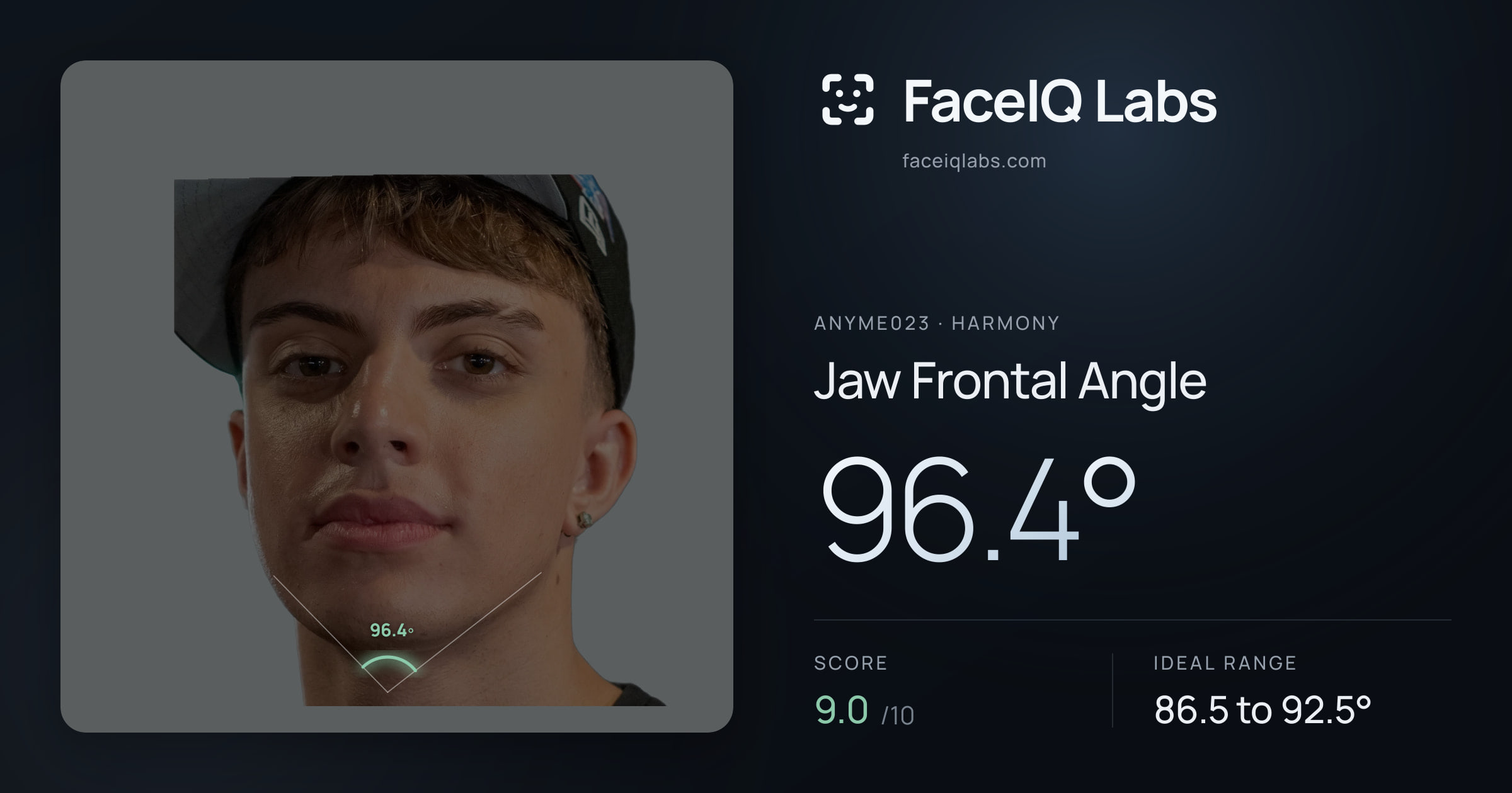 Anyme023 Jaw Frontal Angle: 96.4°, drawn on the photo