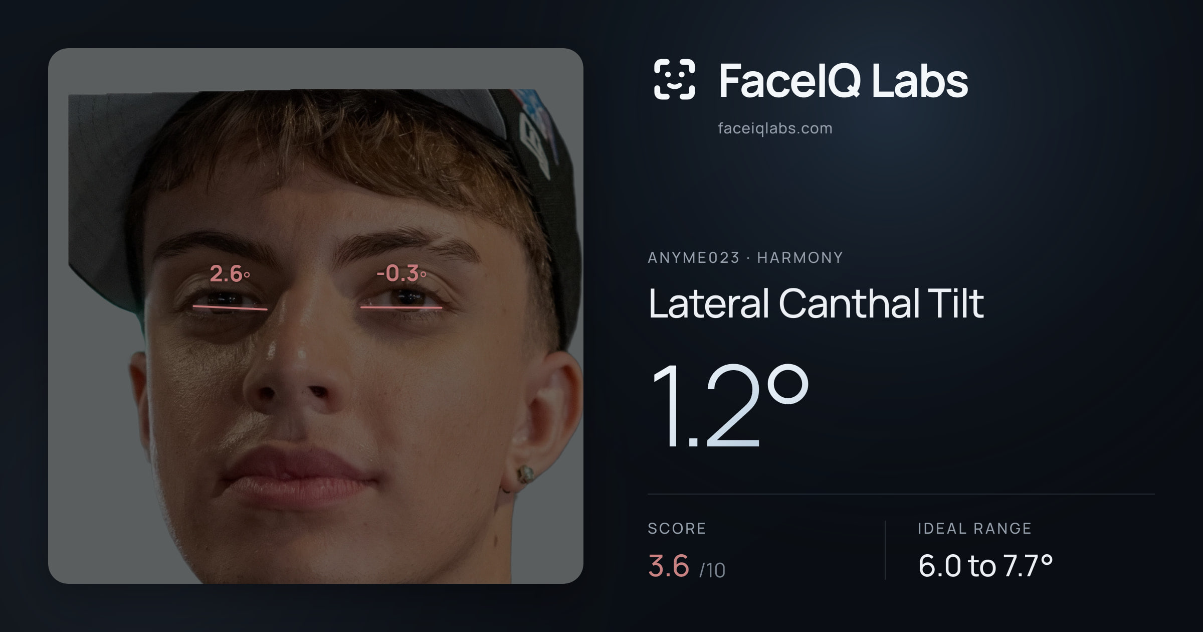 Anyme023 Lateral Canthal Tilt: 1.2°, drawn on the photo