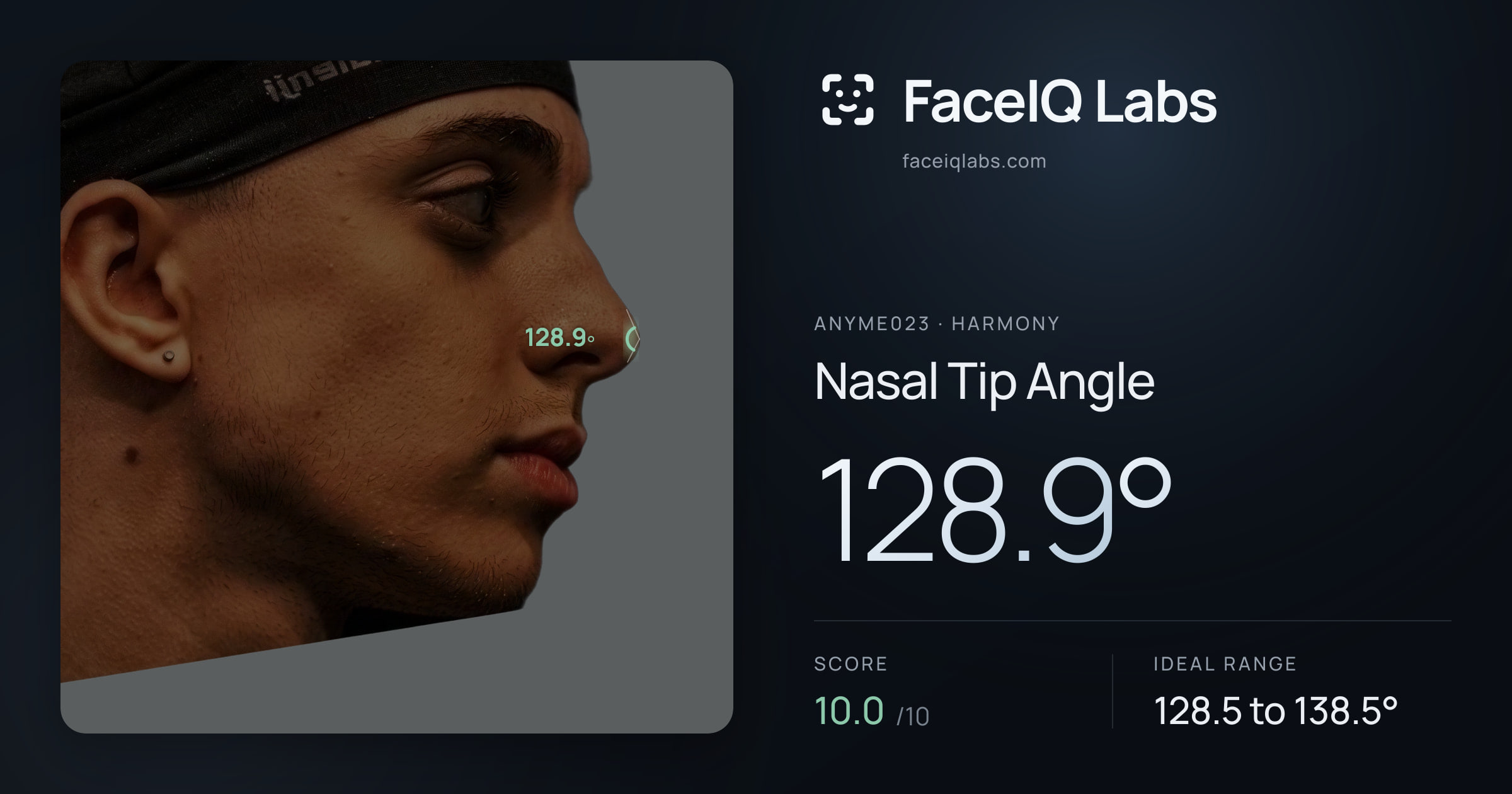Anyme023 Nasal Tip Angle: 128.9°, drawn on the photo