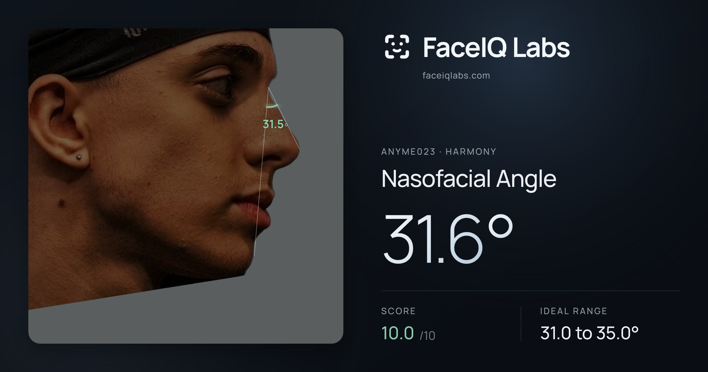Anyme023 Nasofacial Angle: 31.6°, drawn on the photo