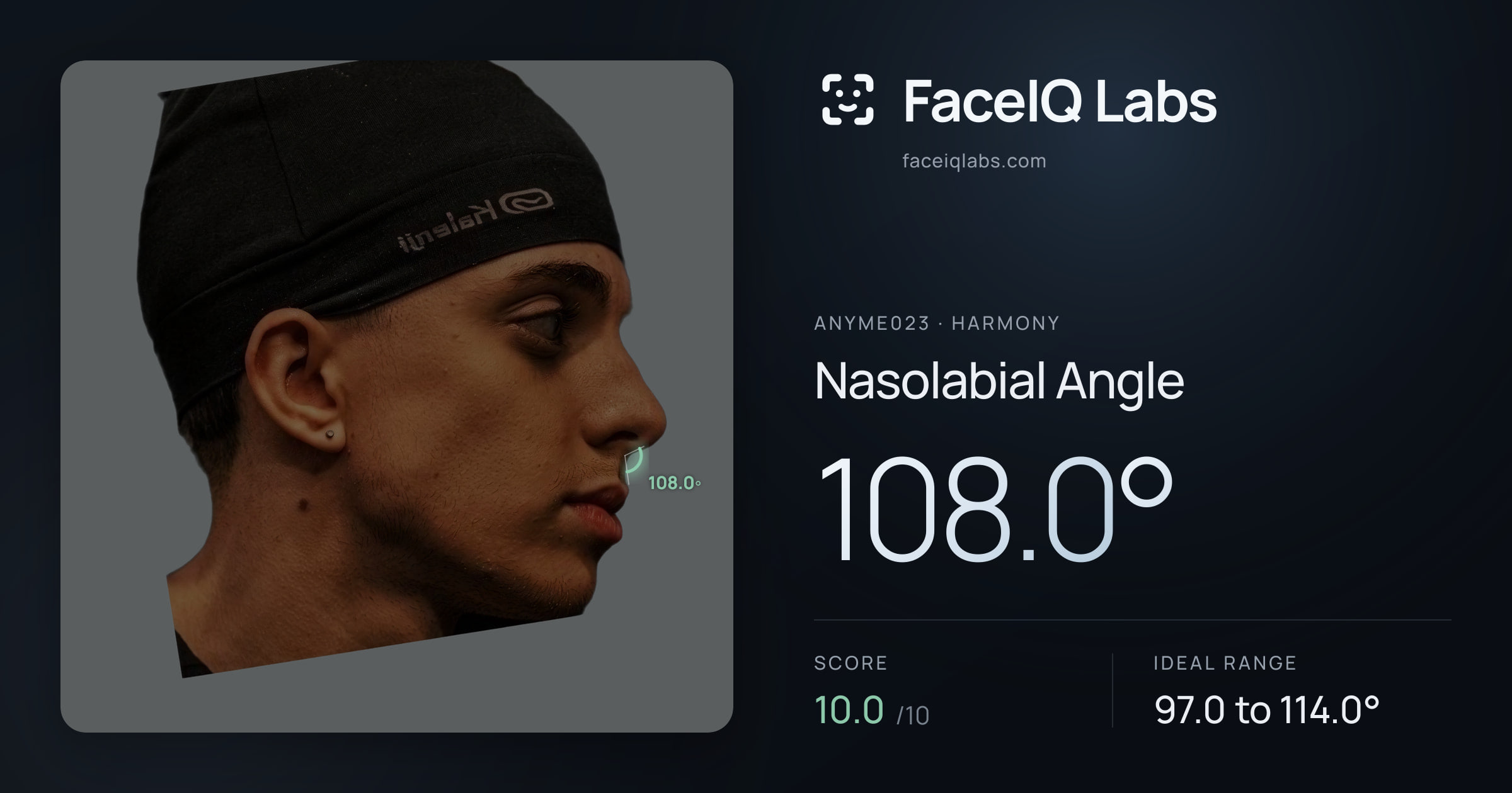 Anyme023 Nasolabial Angle: 108.0°, drawn on the photo