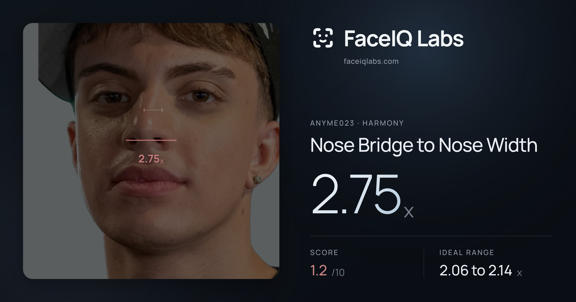 Anyme023 Nose Bridge to Nose Width: 2.75x, drawn on the photo