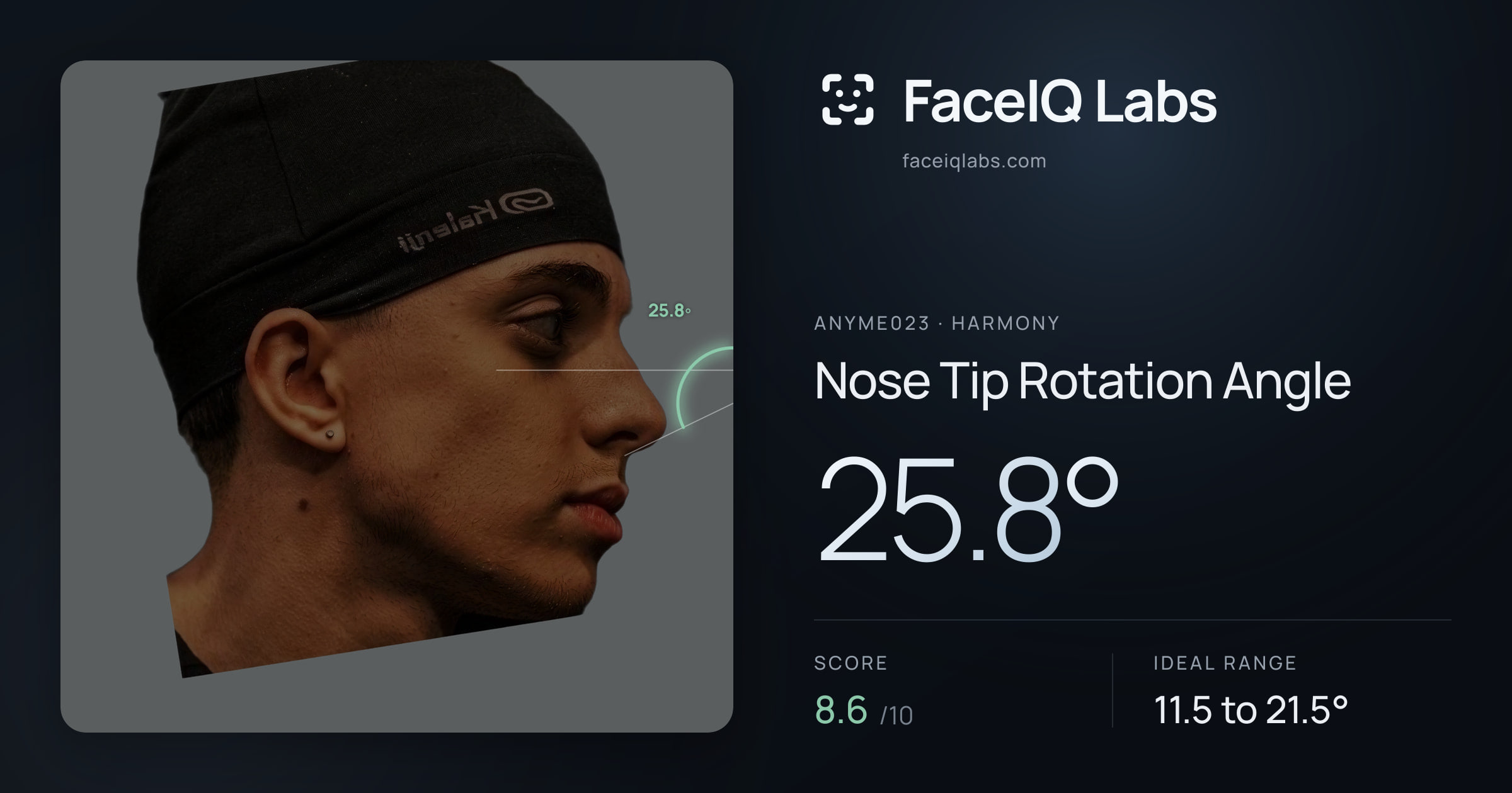 Anyme023 Nose Tip Rotation Angle: 25.8°, drawn on the photo