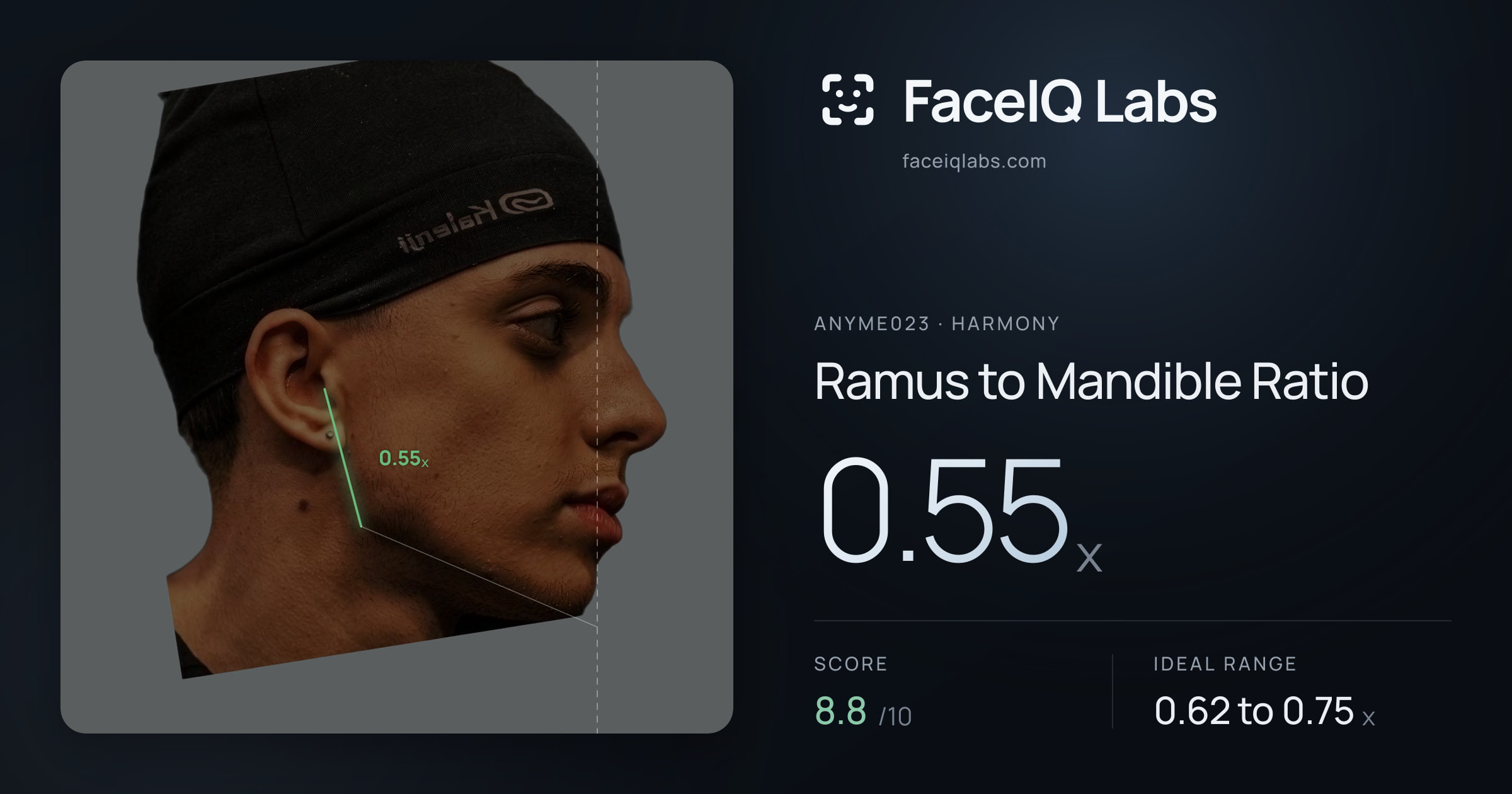 Anyme023 Ramus to Mandible Ratio: 0.55x, drawn on the photo