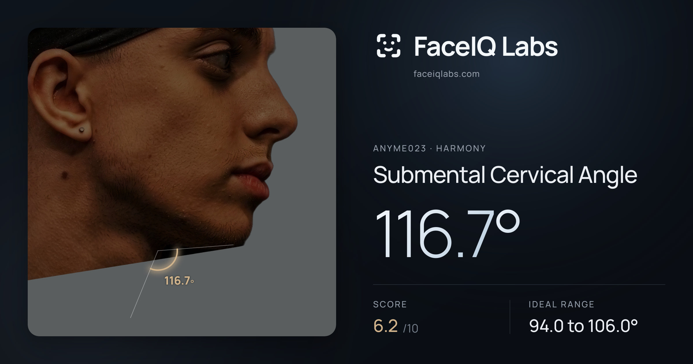 Anyme023 Submental Cervical Angle: 116.7°, drawn on the photo