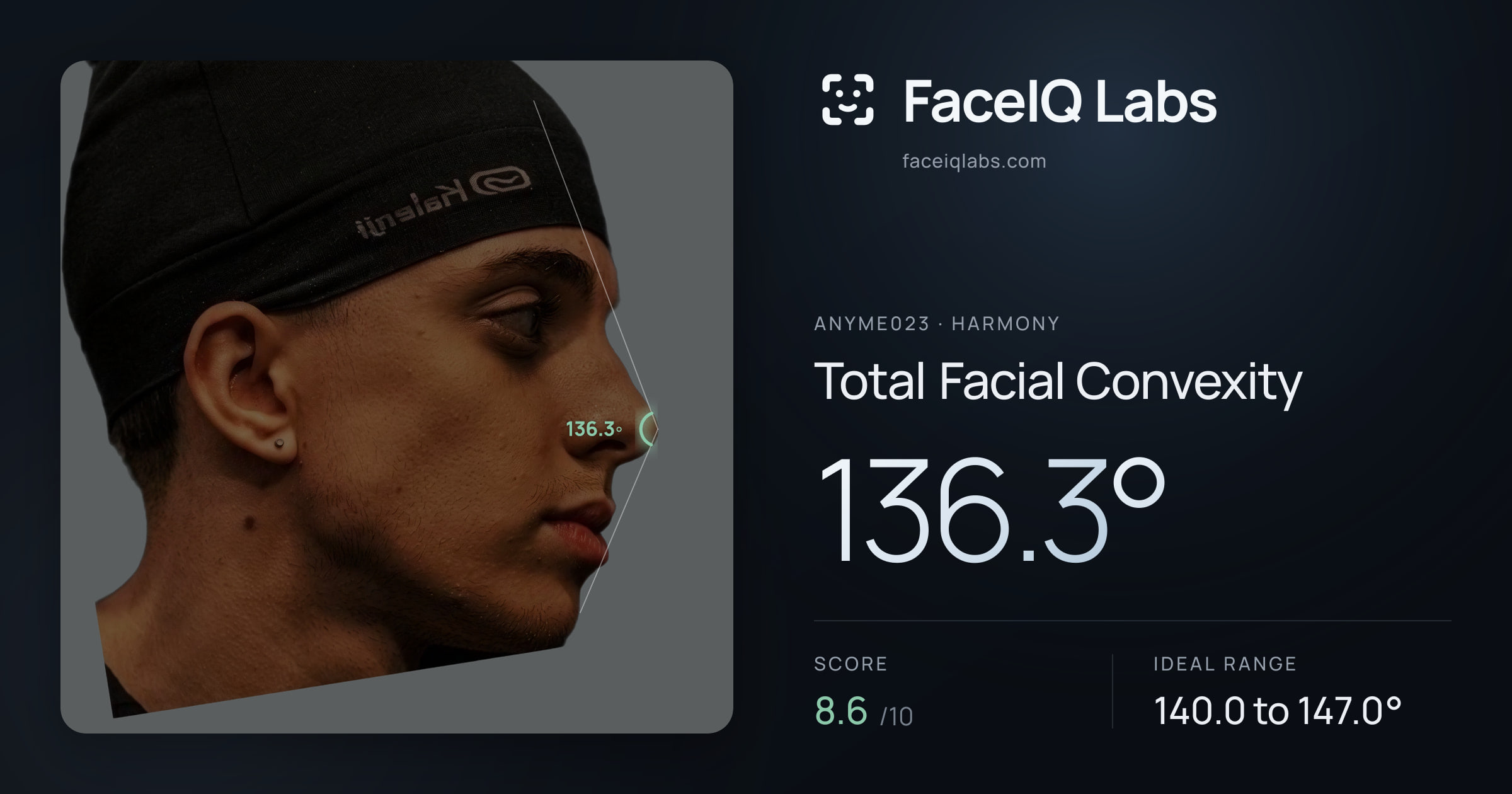 Anyme023 Total Facial Convexity: 136.3°, drawn on the photo