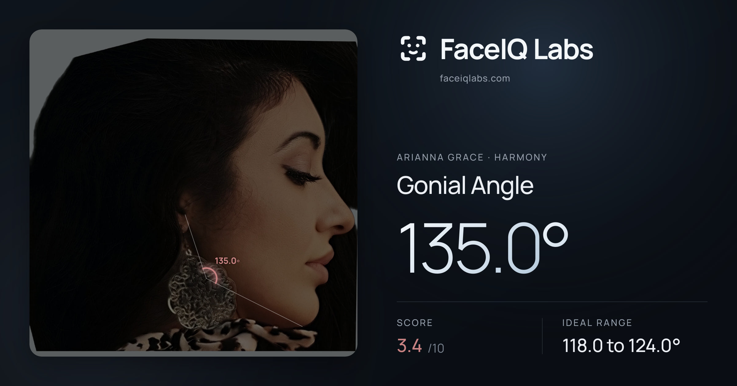 Arianna Grace Gonial Angle: 135.0°, drawn on the photo