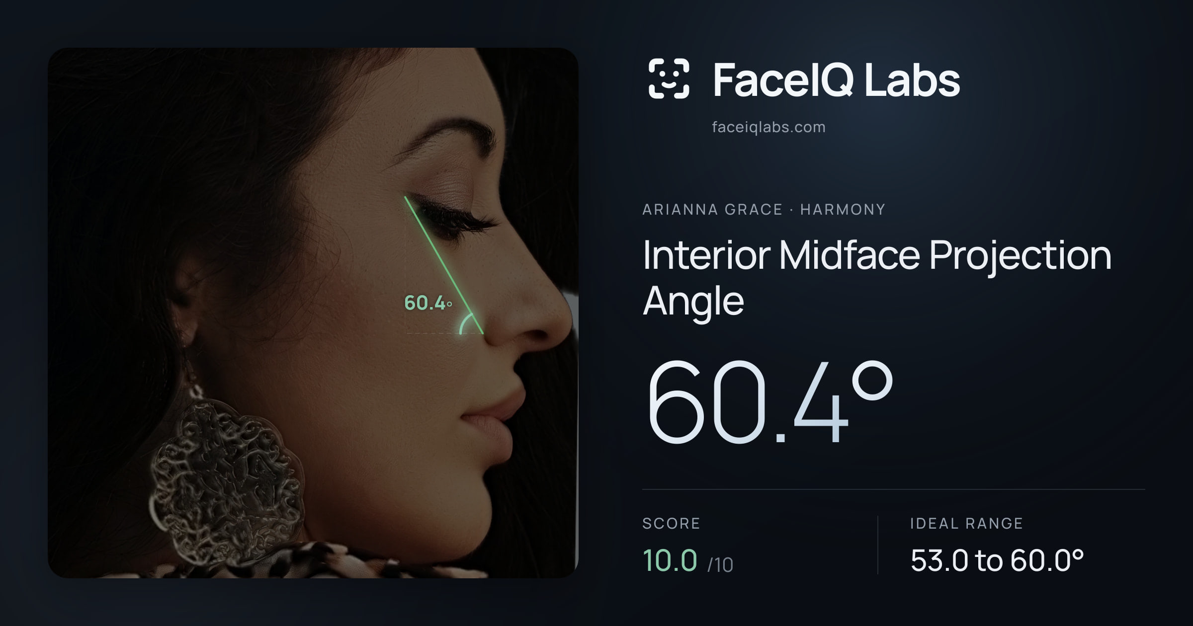 Arianna Grace Interior Midface Projection Angle: 60.4°, drawn on the photo