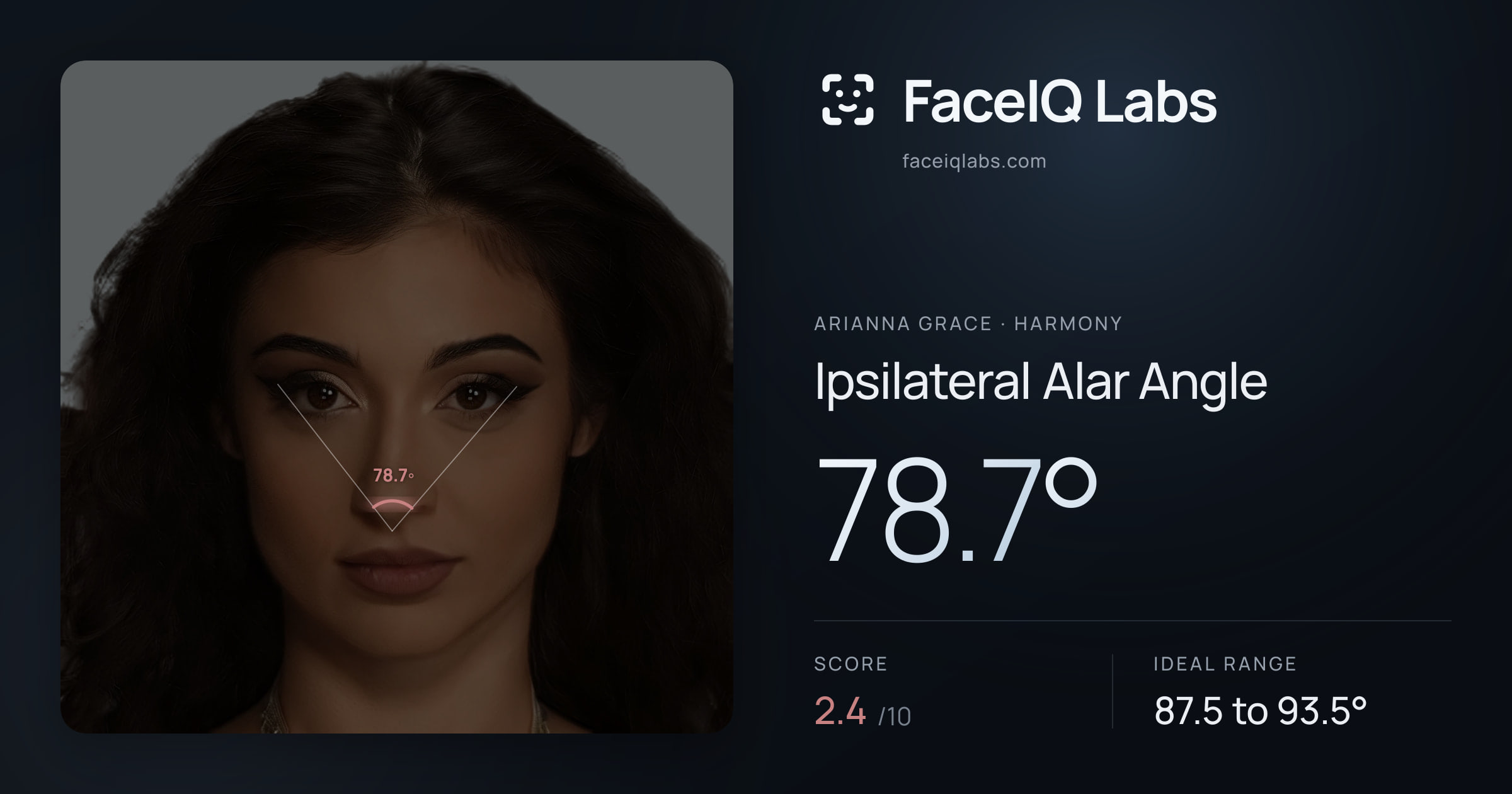 Arianna Grace Ipsilateral Alar Angle: 78.7°, drawn on the photo