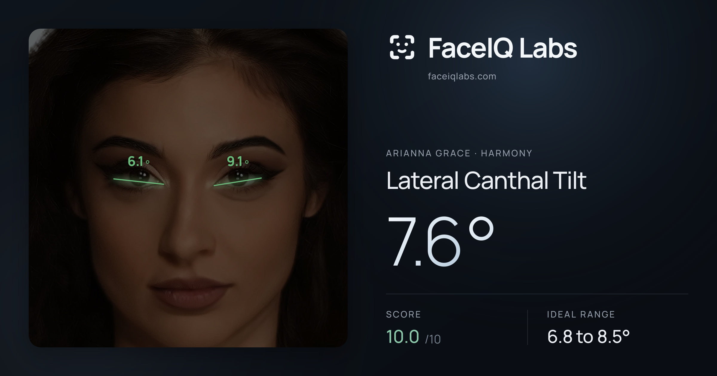 Arianna Grace Lateral Canthal Tilt: 7.6°, drawn on the photo