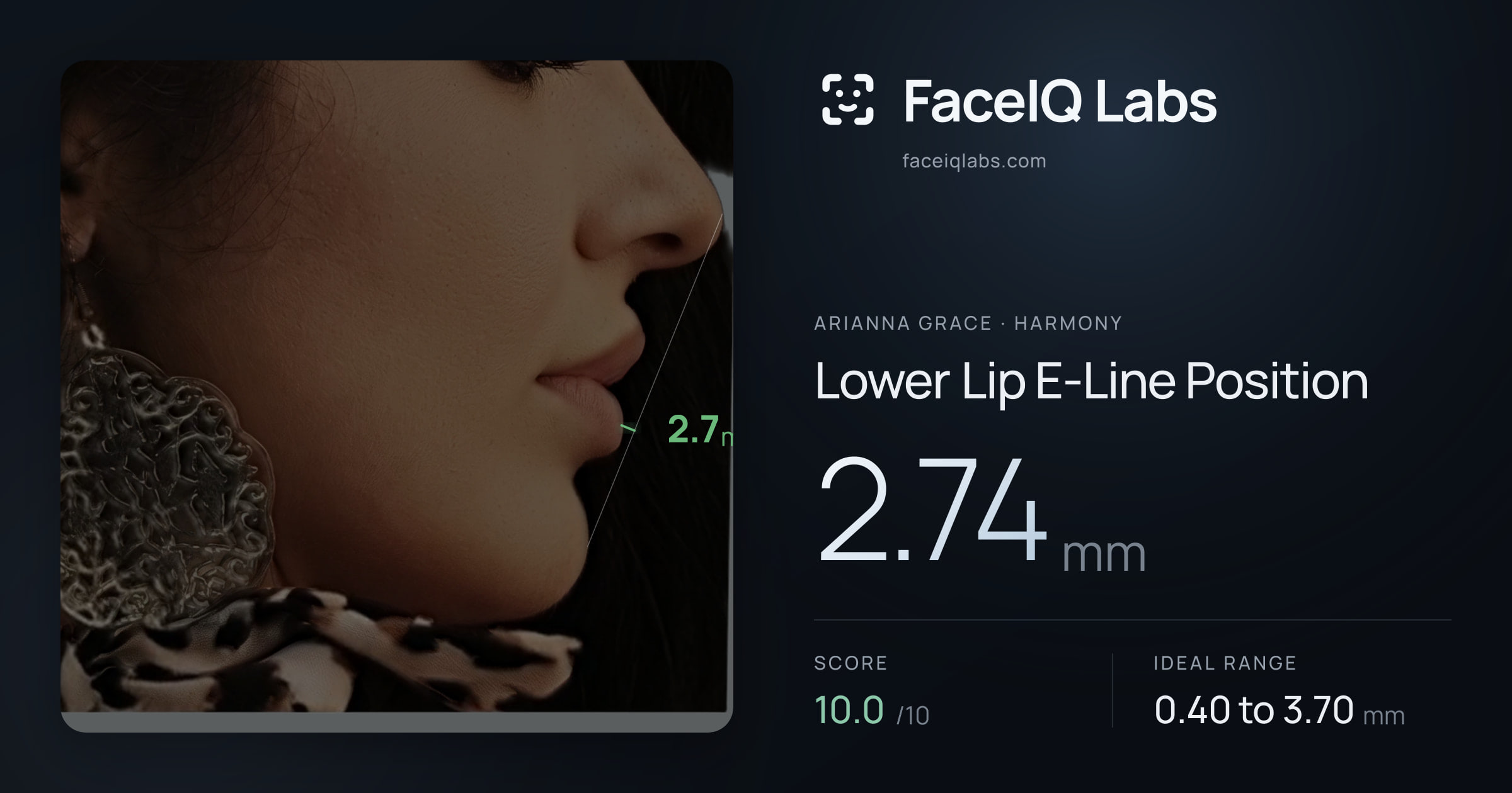 Arianna Grace Lower Lip E-Line Position: 2.74mm, drawn on the photo