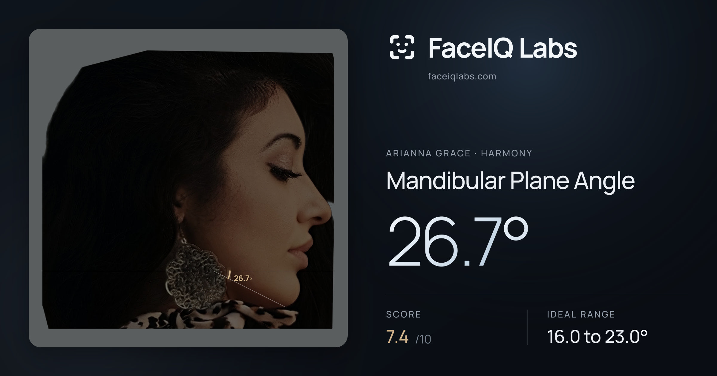 Arianna Grace Mandibular Plane Angle: 26.7°, drawn on the photo