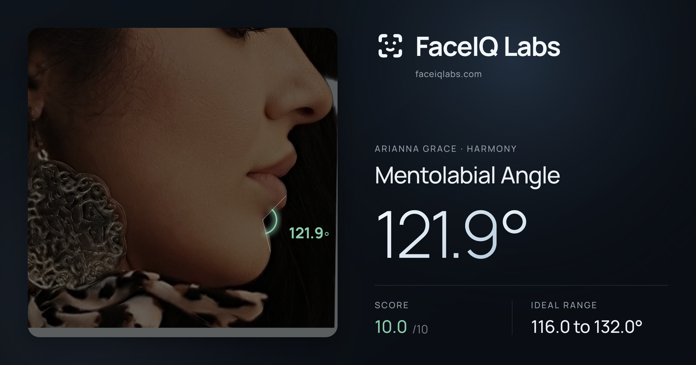 Arianna Grace Mentolabial Angle: 121.9°, drawn on the photo