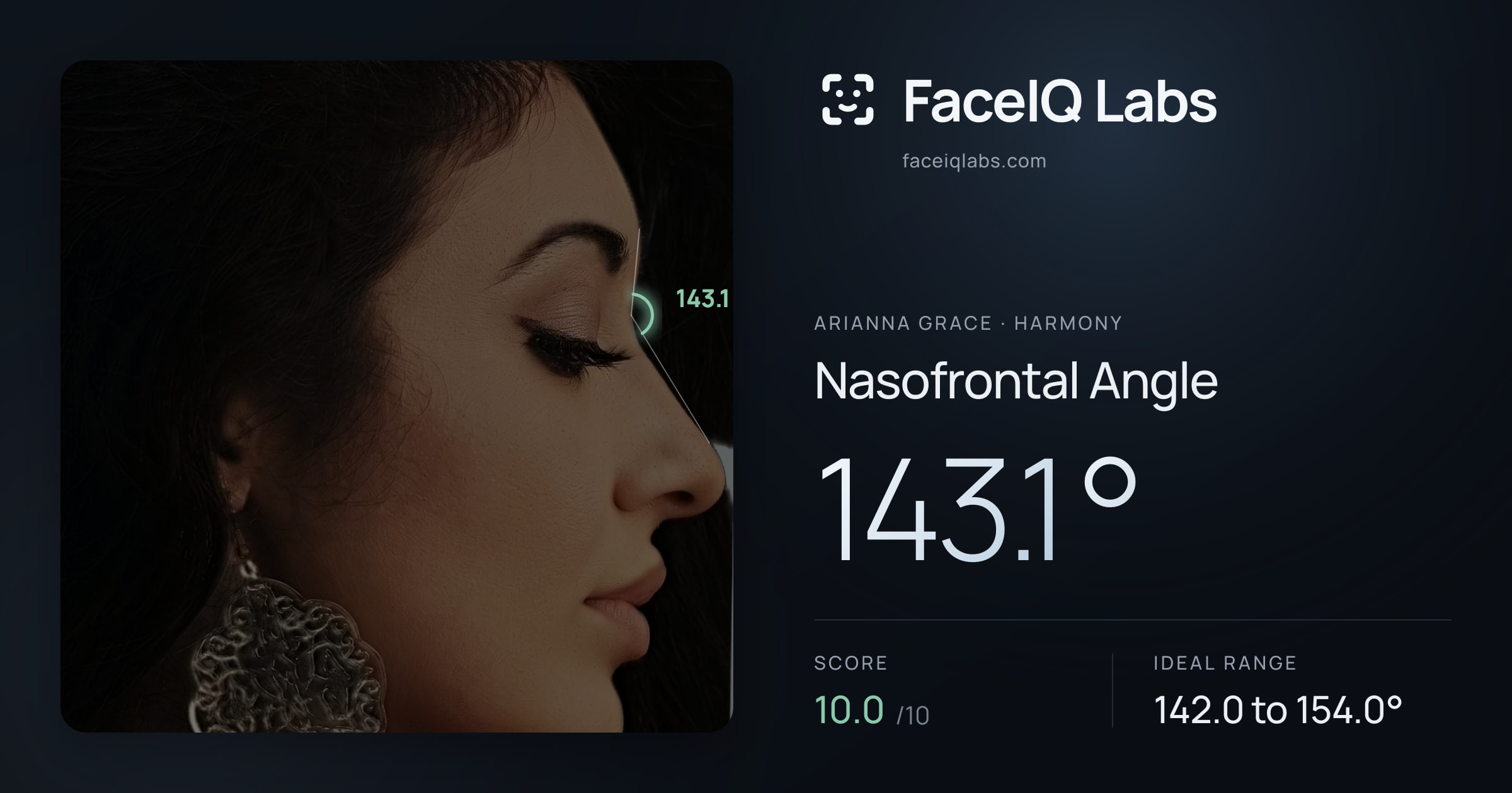 Arianna Grace Nasofrontal Angle: 143.1°, drawn on the photo