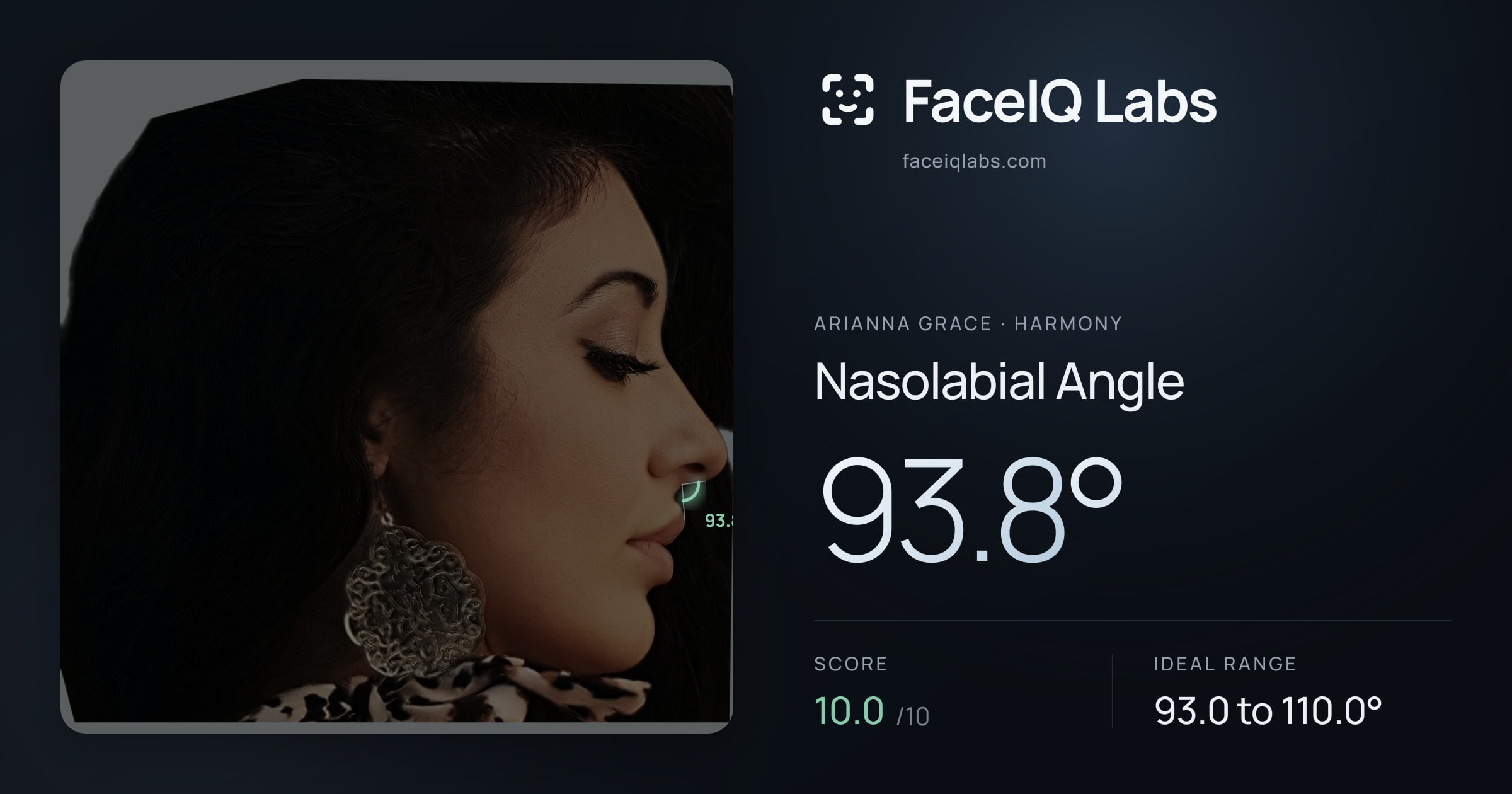 Arianna Grace Nasolabial Angle: 93.8°, drawn on the photo