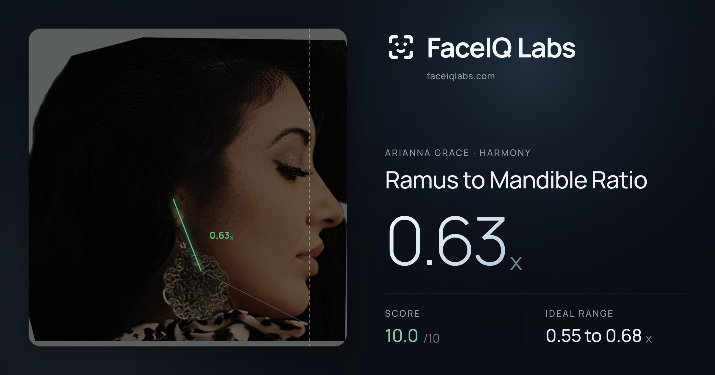 Arianna Grace Ramus to Mandible Ratio: 0.63x, drawn on the photo